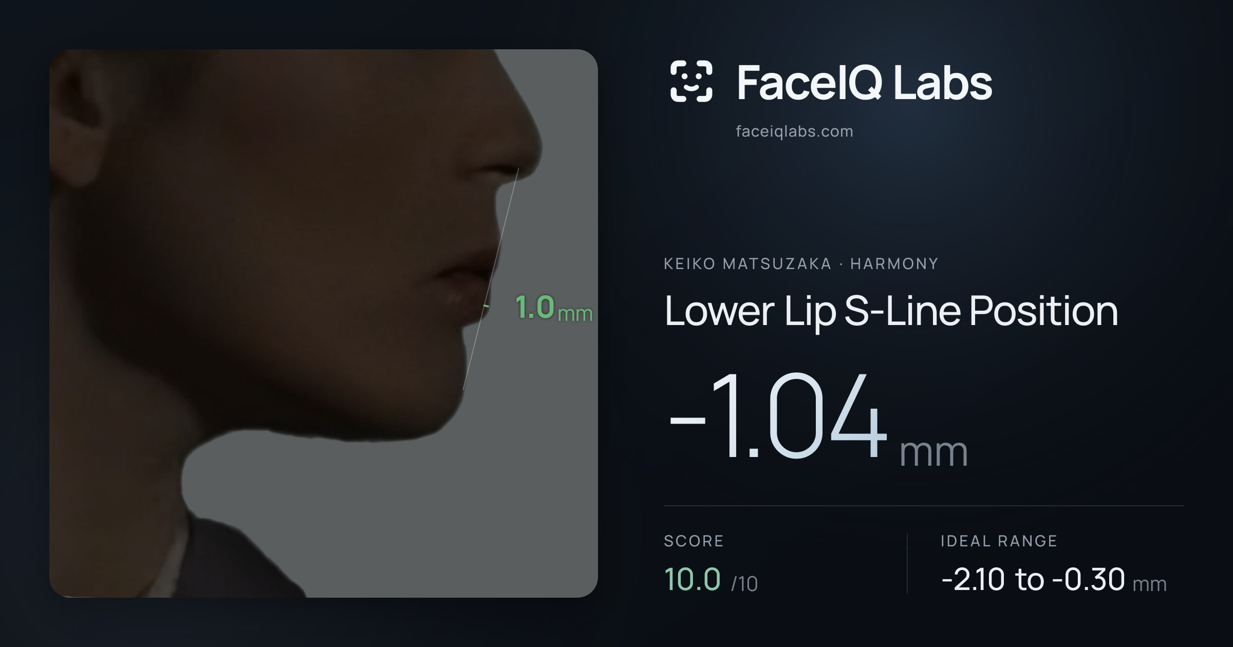 Keiko Matsuzaka Lower Lip S-Line Position: -1.04mm, drawn on the photo