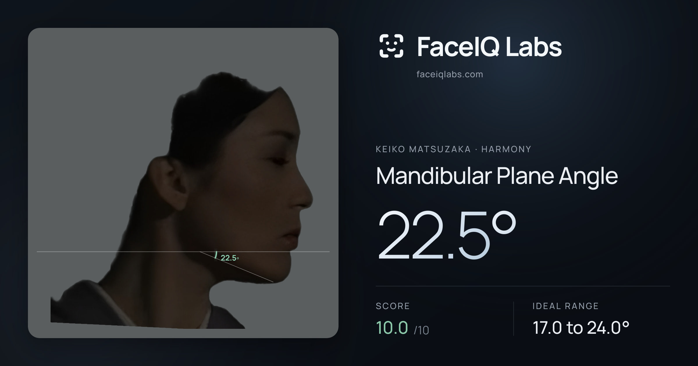 Keiko Matsuzaka Mandibular Plane Angle: 22.5°, drawn on the photo