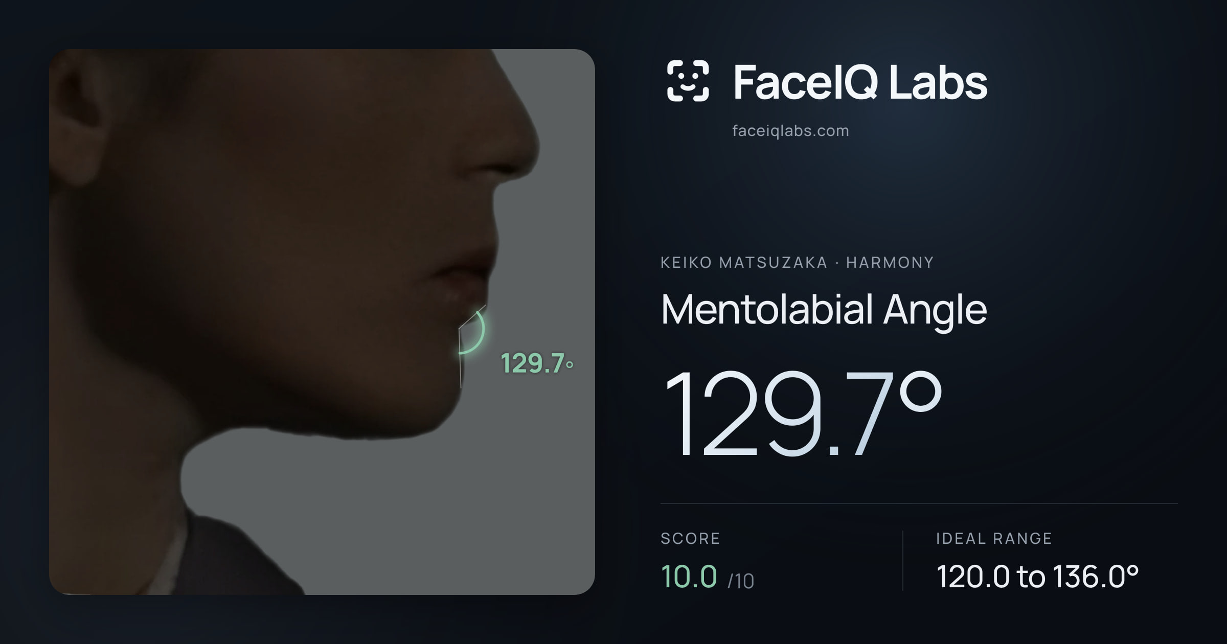 Keiko Matsuzaka Mentolabial Angle: 129.7°, drawn on the photo