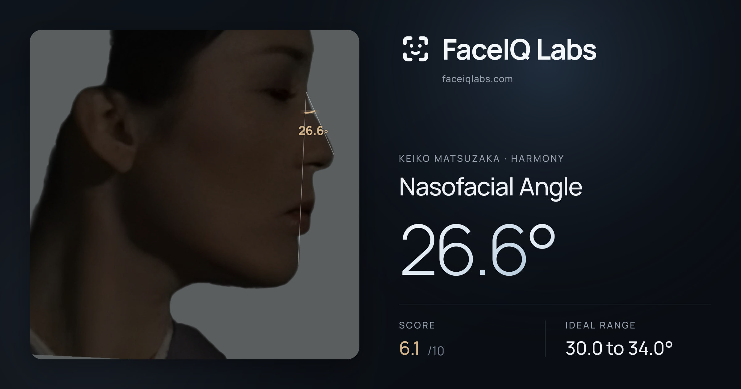 Keiko Matsuzaka Nasofacial Angle: 26.6°, drawn on the photo
