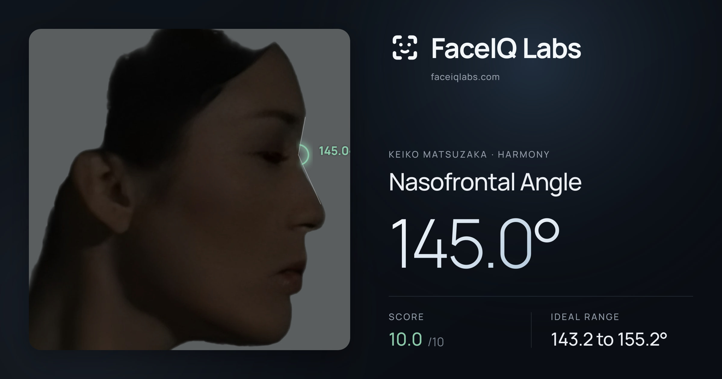 Keiko Matsuzaka Nasofrontal Angle: 145.0°, drawn on the photo