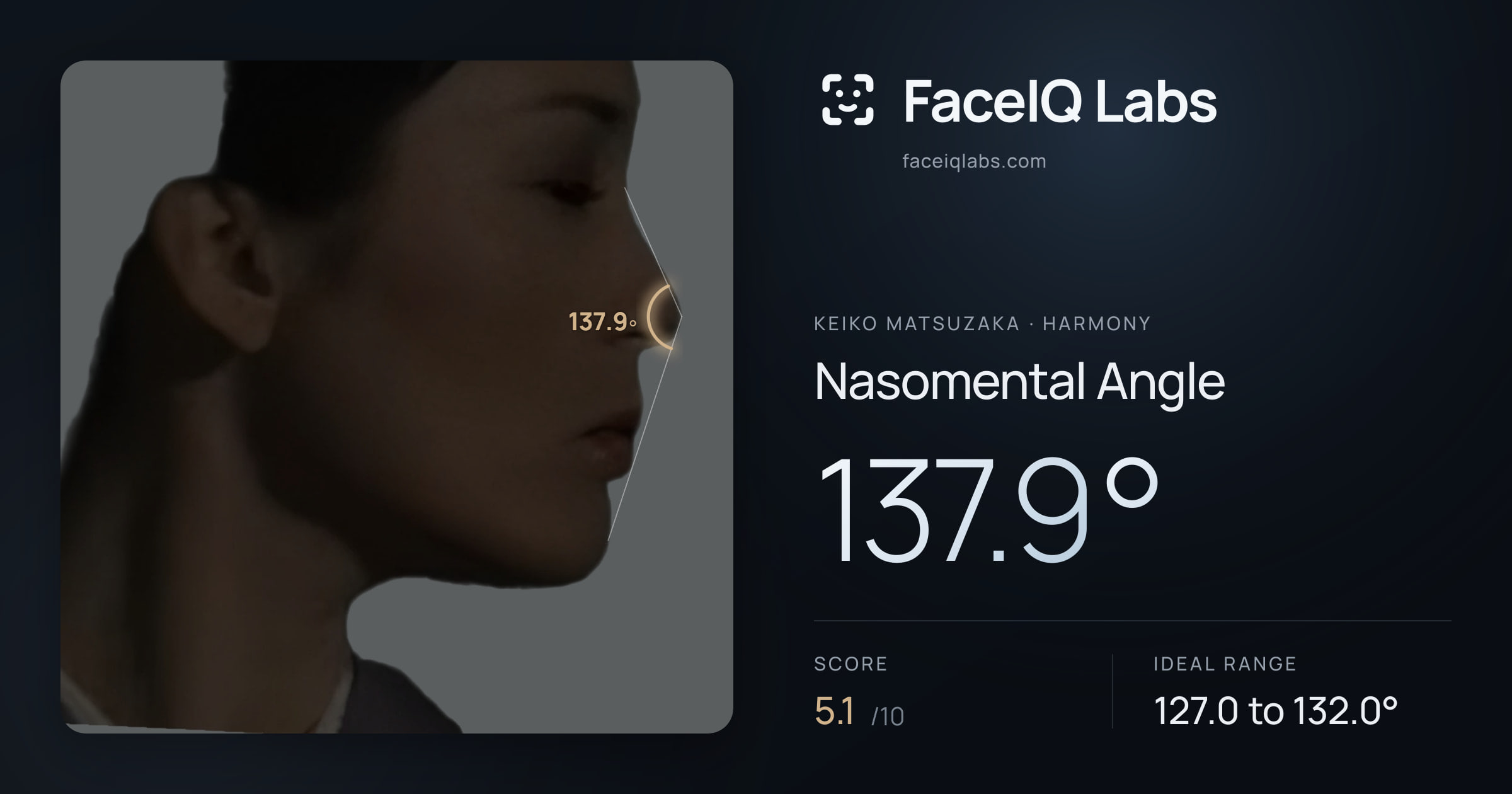 Keiko Matsuzaka Nasomental Angle: 137.9°, drawn on the photo