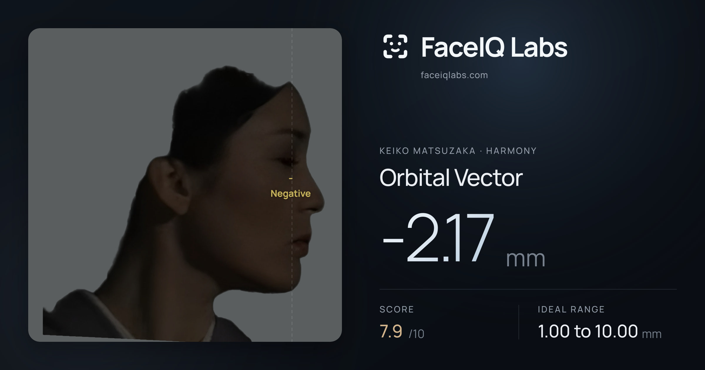 Keiko Matsuzaka Orbital Vector: -2.17mm, drawn on the photo