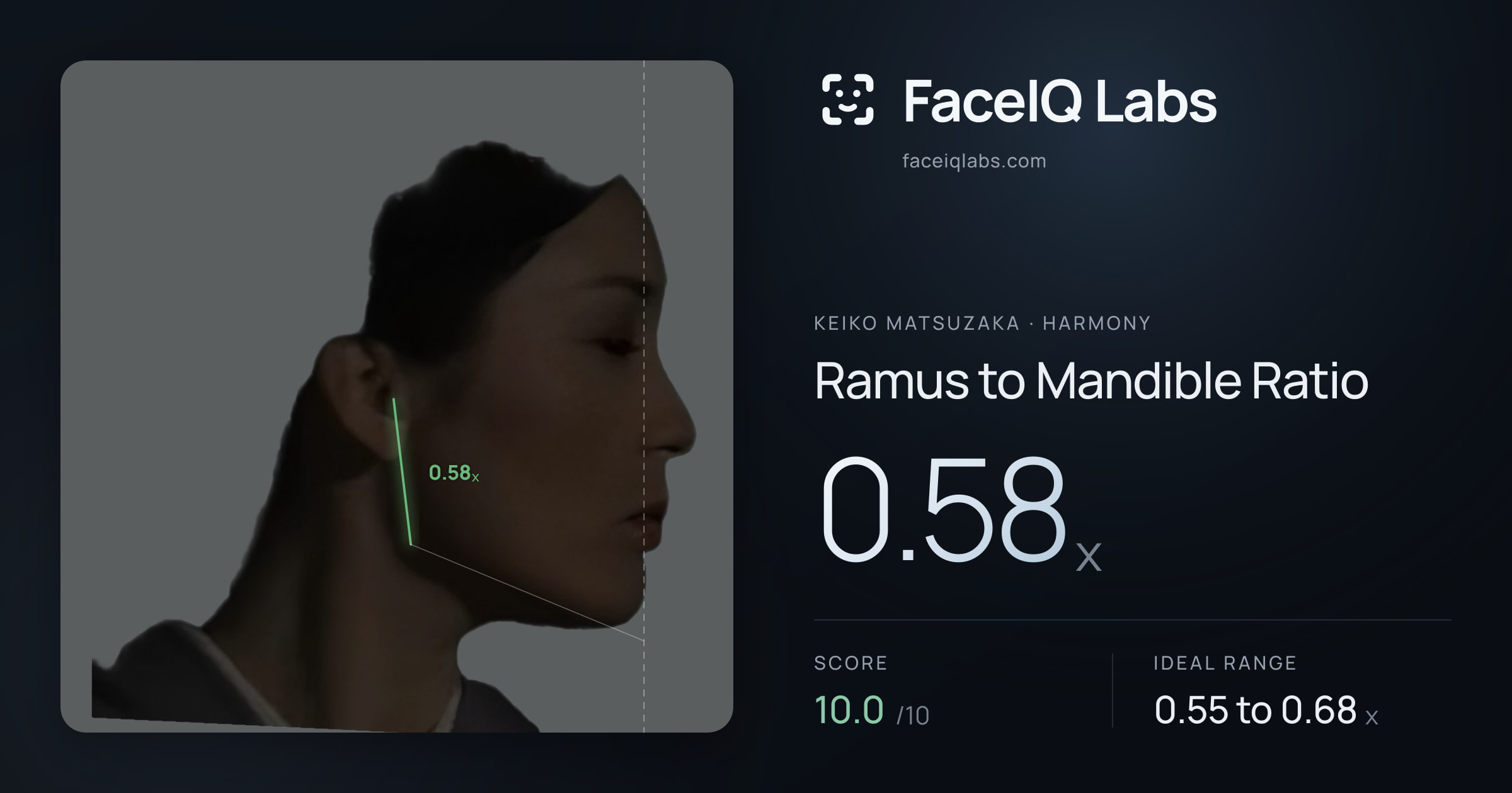 Keiko Matsuzaka Ramus to Mandible Ratio: 0.58x, drawn on the photo