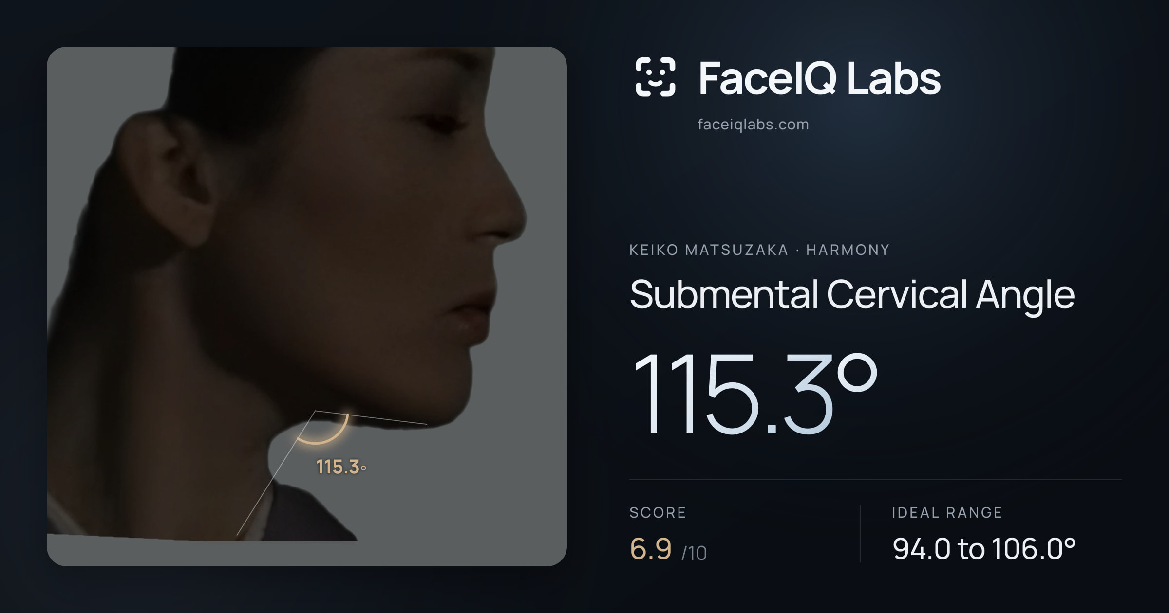 Keiko Matsuzaka Submental Cervical Angle: 115.3°, drawn on the photo