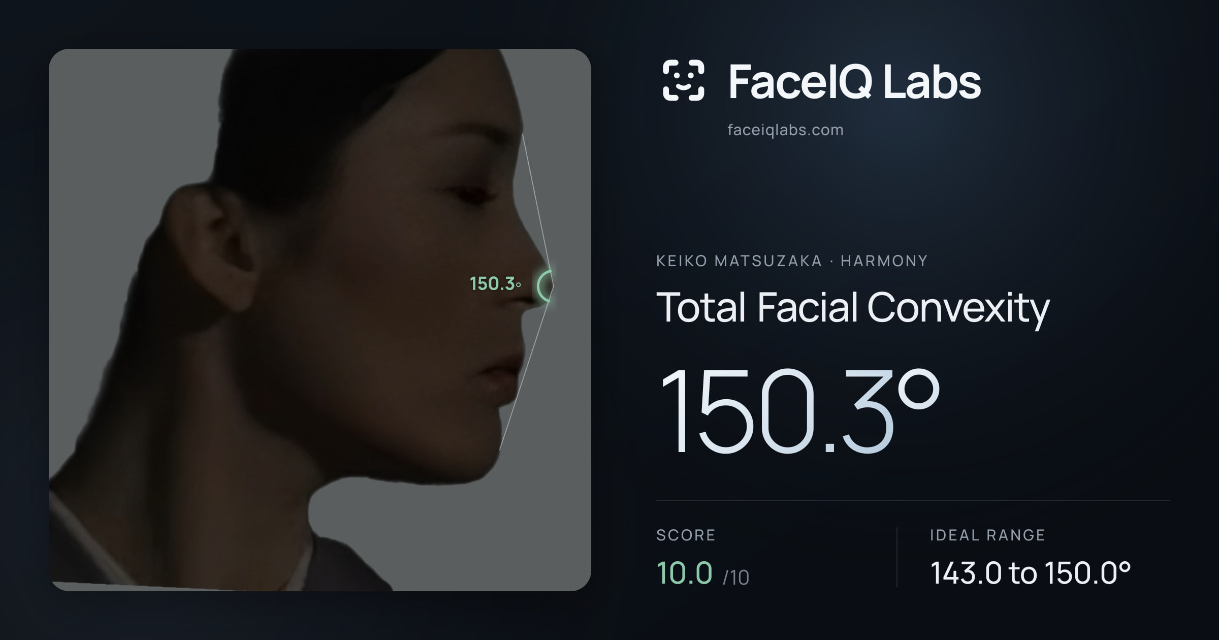 Keiko Matsuzaka Total Facial Convexity: 150.3°, drawn on the photo