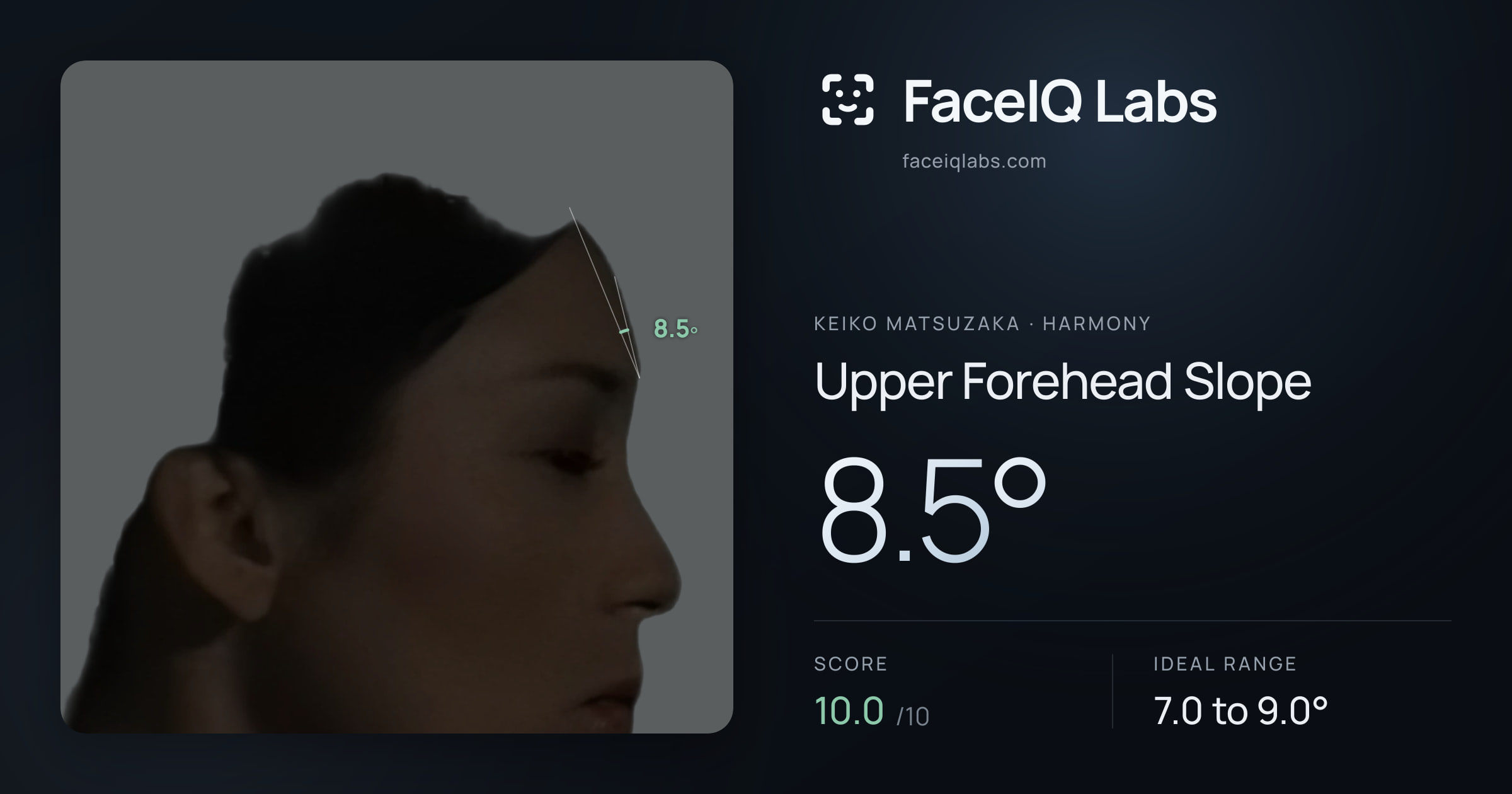 Keiko Matsuzaka Upper Forehead Slope: 8.5°, drawn on the photo