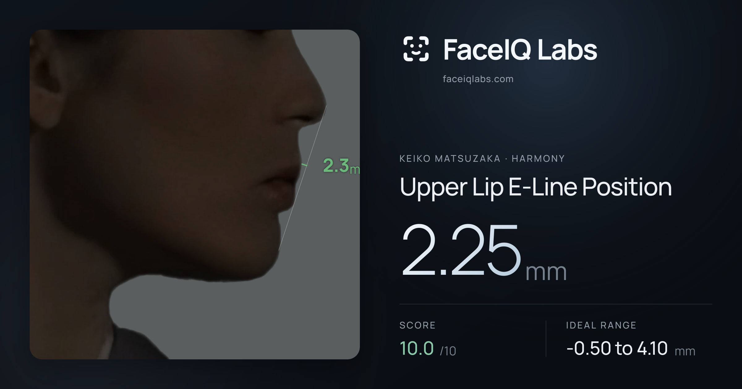 Keiko Matsuzaka Upper Lip E-Line Position: 2.25mm, drawn on the photo