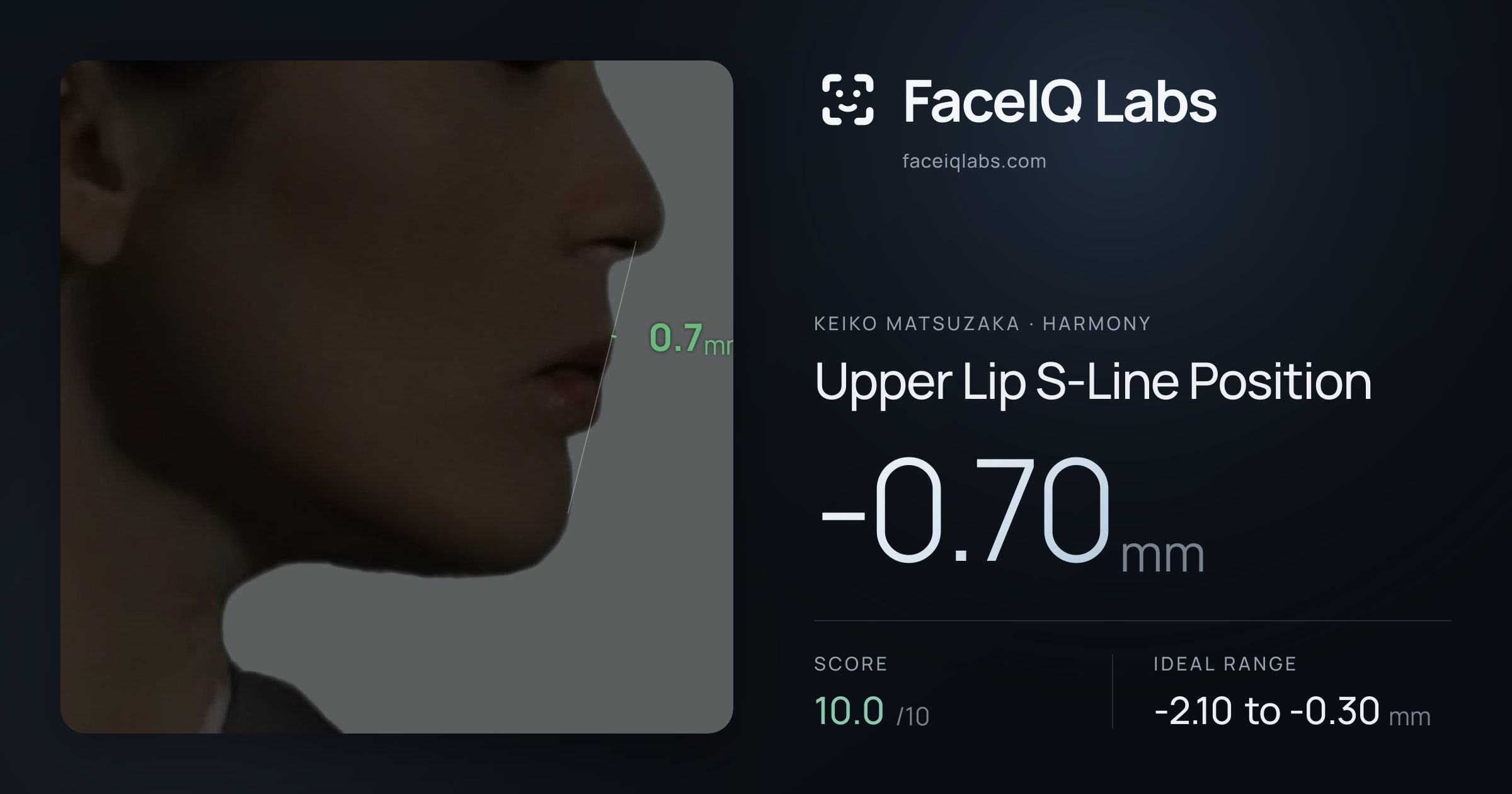 Keiko Matsuzaka Upper Lip S-Line Position: -0.70mm, drawn on the photo