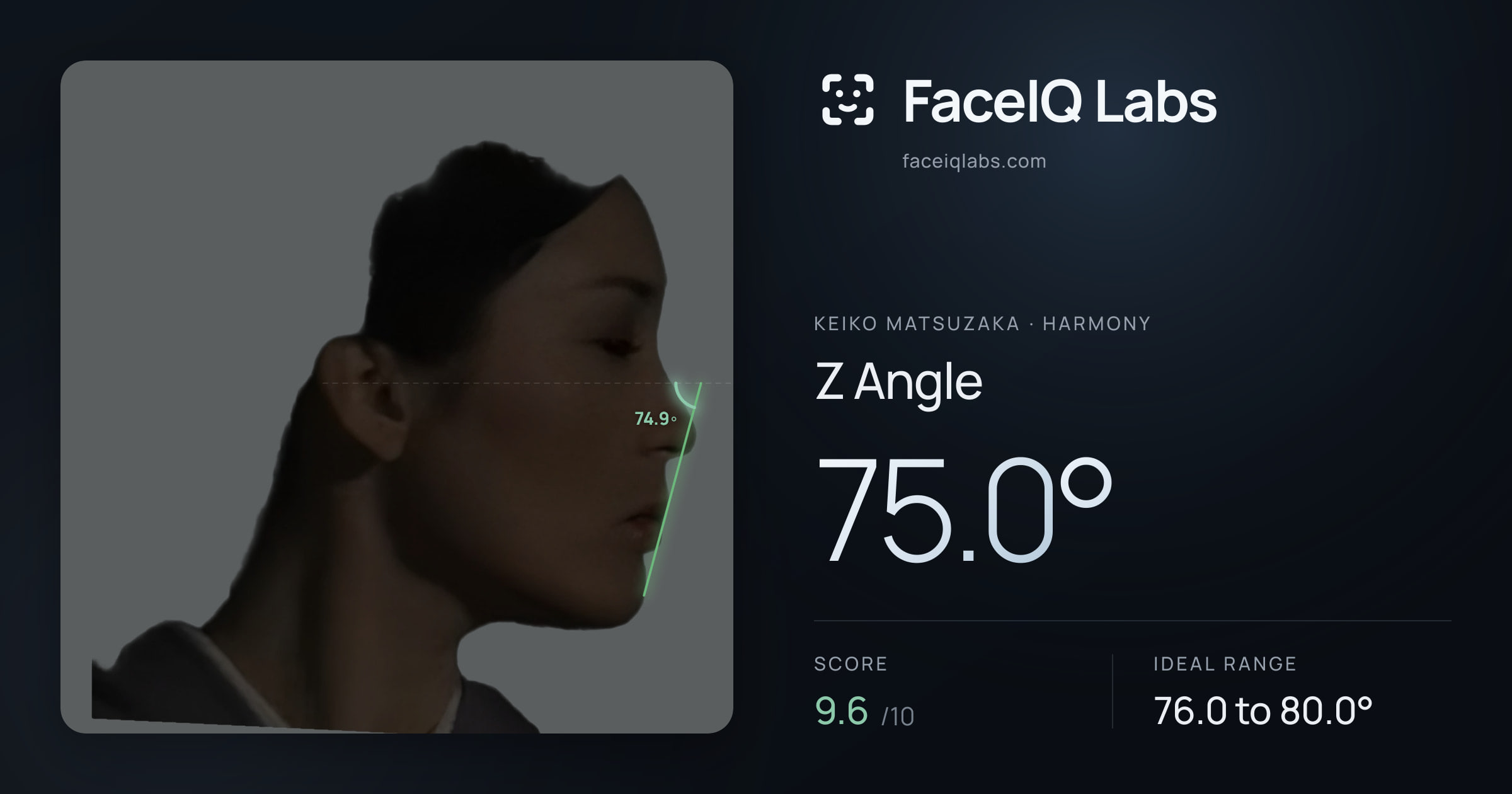 Keiko Matsuzaka Z Angle: 75.0°, drawn on the photo