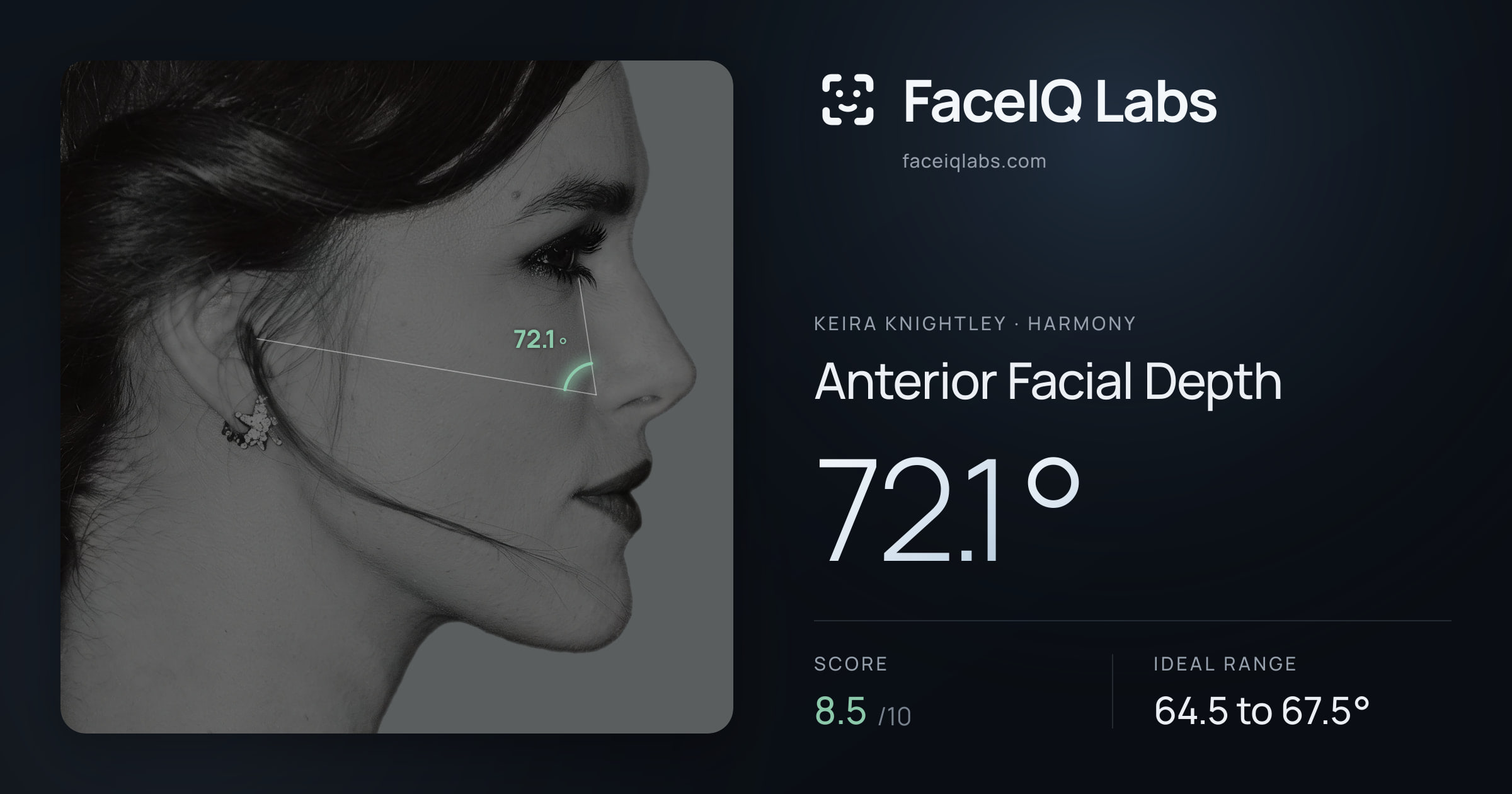 Keira Knightley Anterior Facial Depth: 72.1°, drawn on the photo