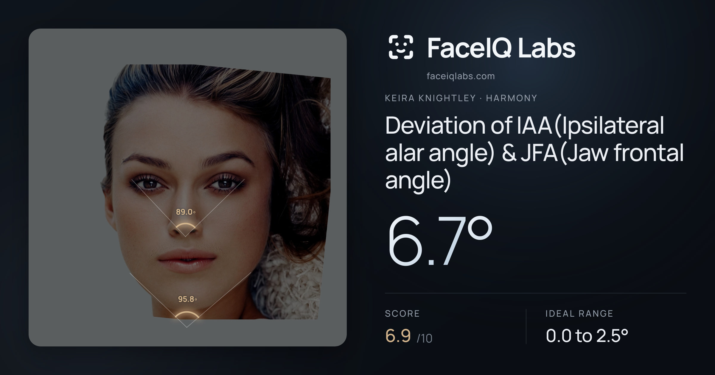 Keira Knightley Deviation of IAA(Ipsilateral alar angle) & JFA(Jaw frontal angle): 6.7°, drawn on the photo
