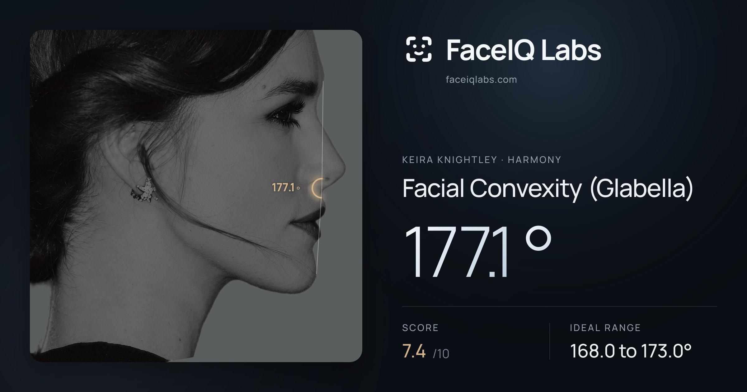 Keira Knightley Facial Convexity (Glabella): 177.1°, drawn on the photo