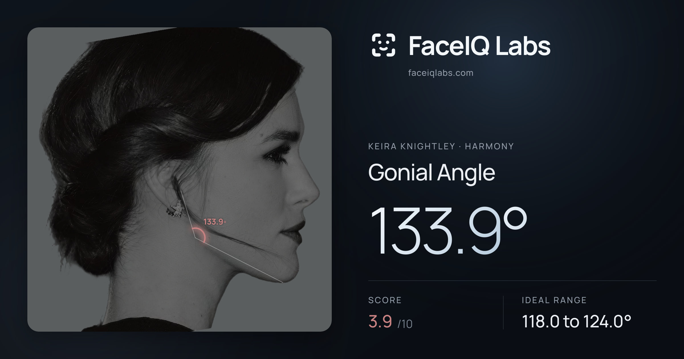 Keira Knightley Gonial Angle: 133.9°, drawn on the photo