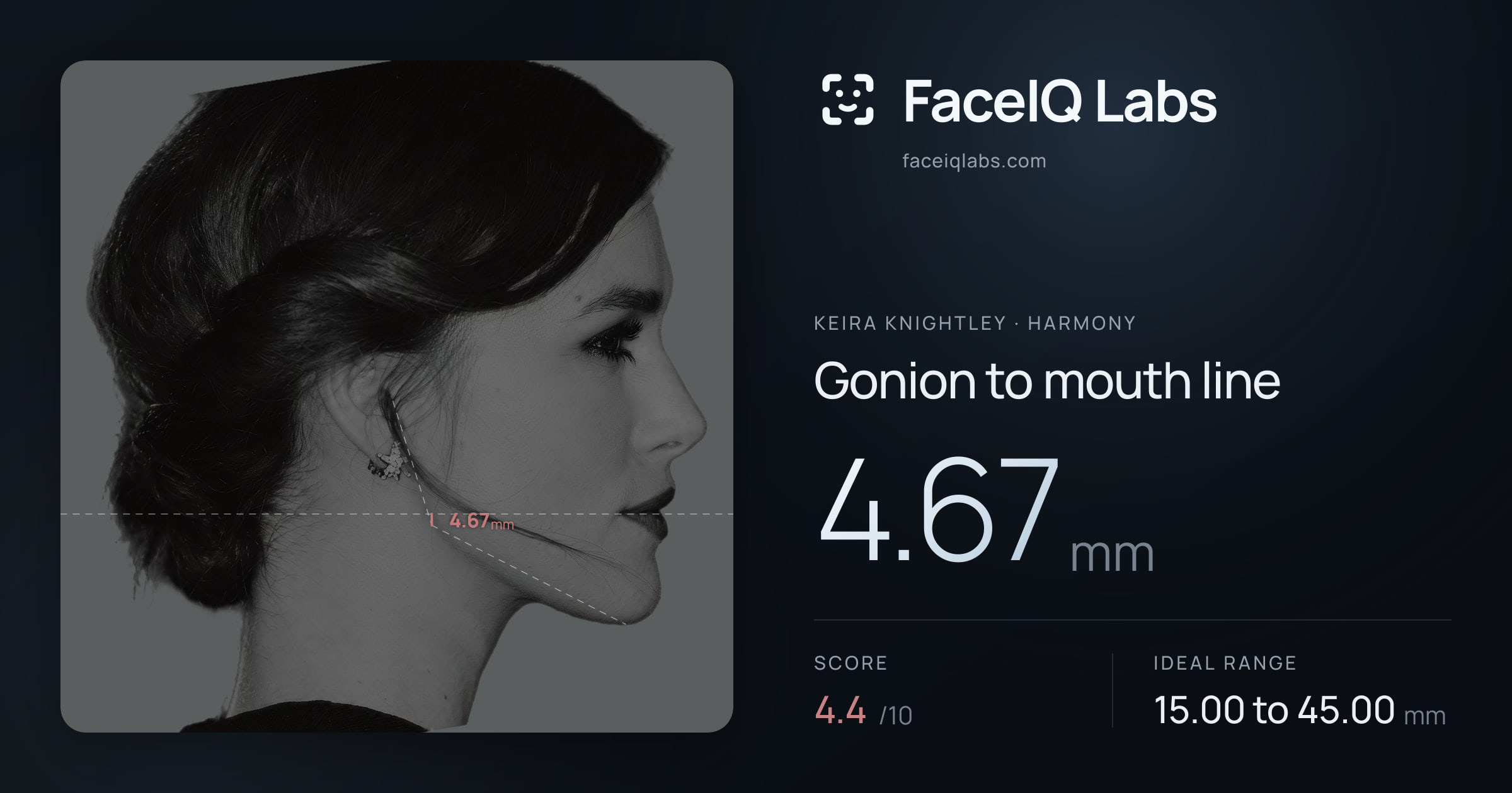 Keira Knightley Gonion to mouth line: 4.67mm, drawn on the photo