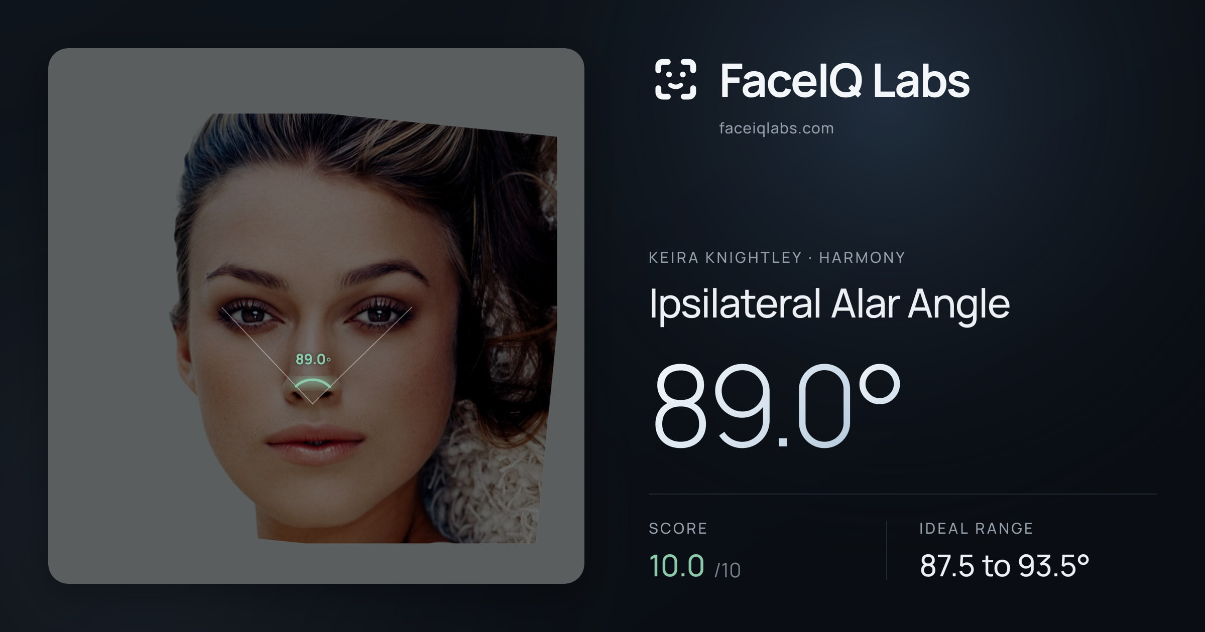 Keira Knightley Ipsilateral Alar Angle: 89.0°, drawn on the photo
