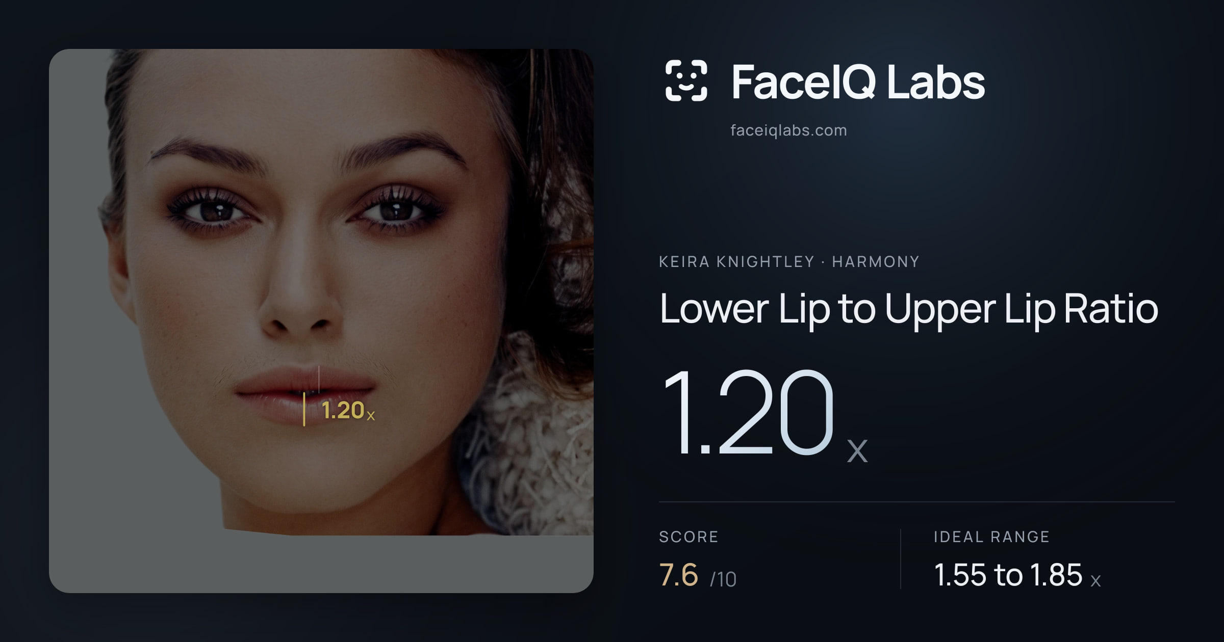 Keira Knightley Lower Lip to Upper Lip Ratio: 1.20x, drawn on the photo
