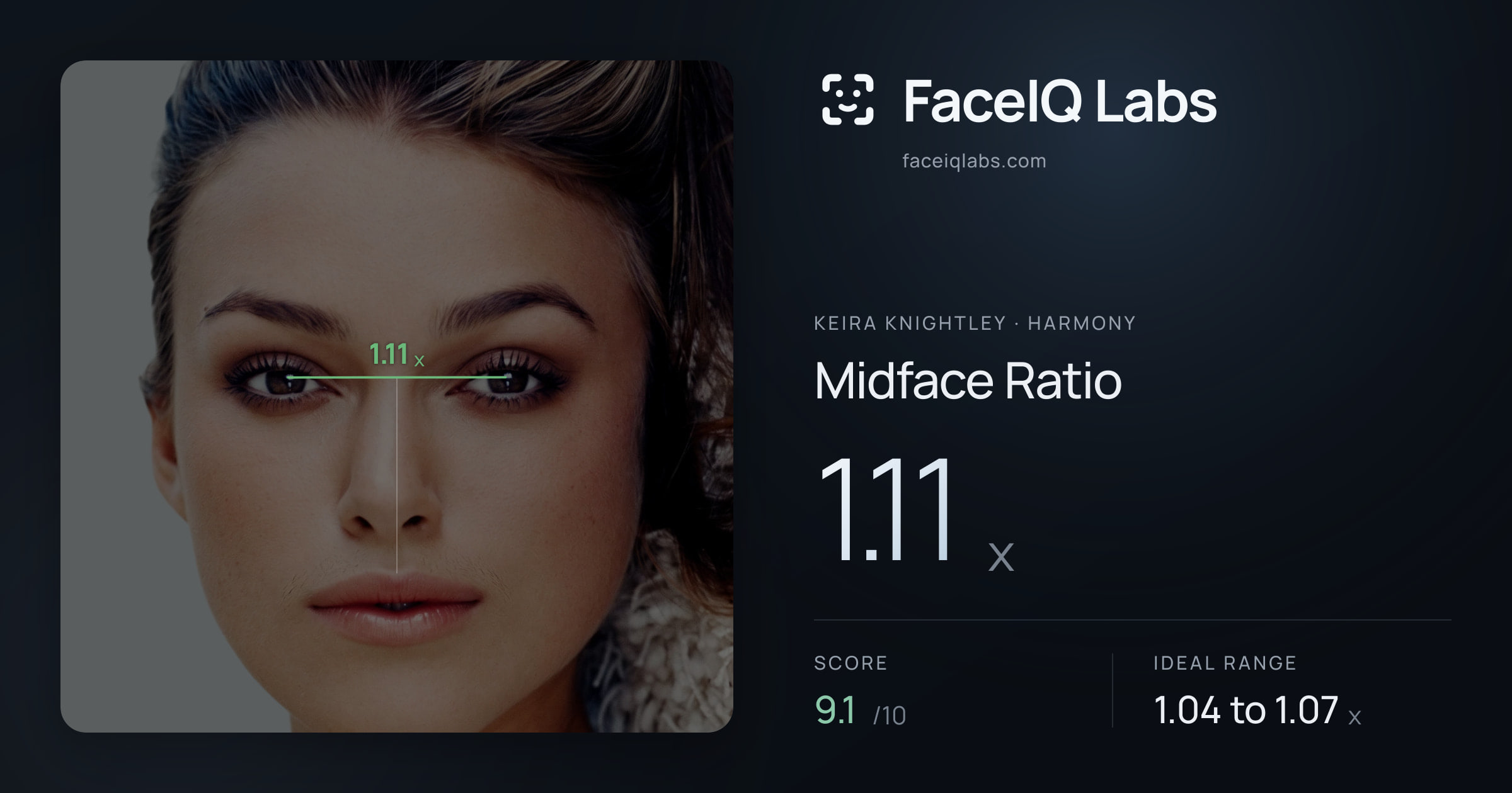 Keira Knightley Midface Ratio: 1.11x, drawn on the photo