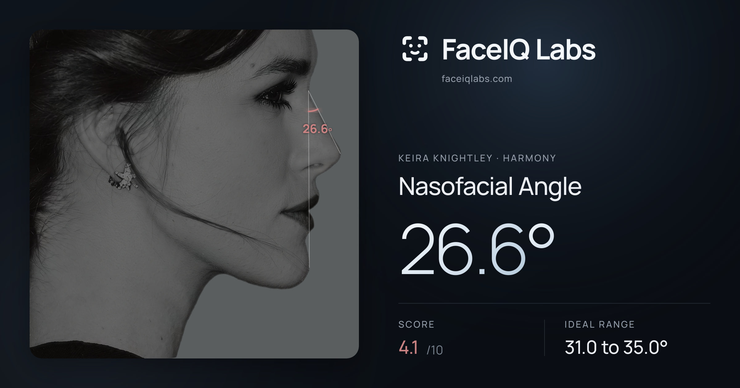 Keira Knightley Nasofacial Angle: 26.6°, drawn on the photo