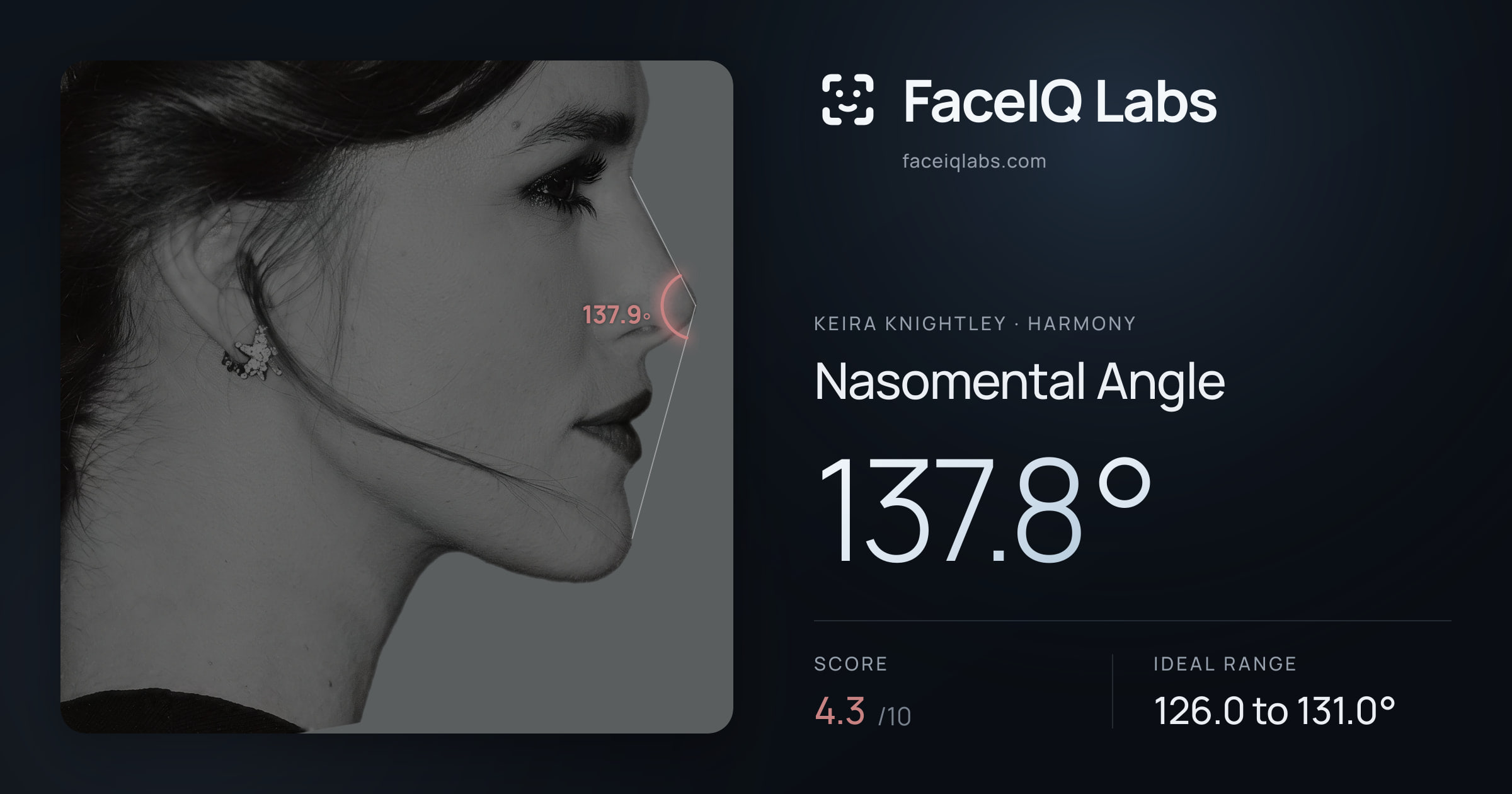 Keira Knightley Nasomental Angle: 137.8°, drawn on the photo