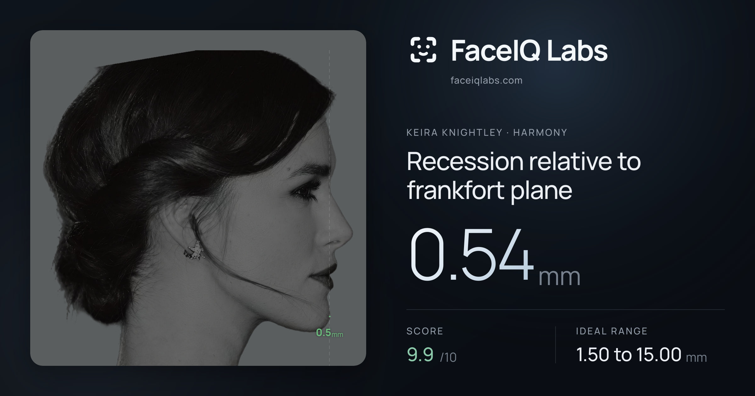 Keira Knightley Recession relative to frankfort plane: 0.54mm, drawn on the photo
