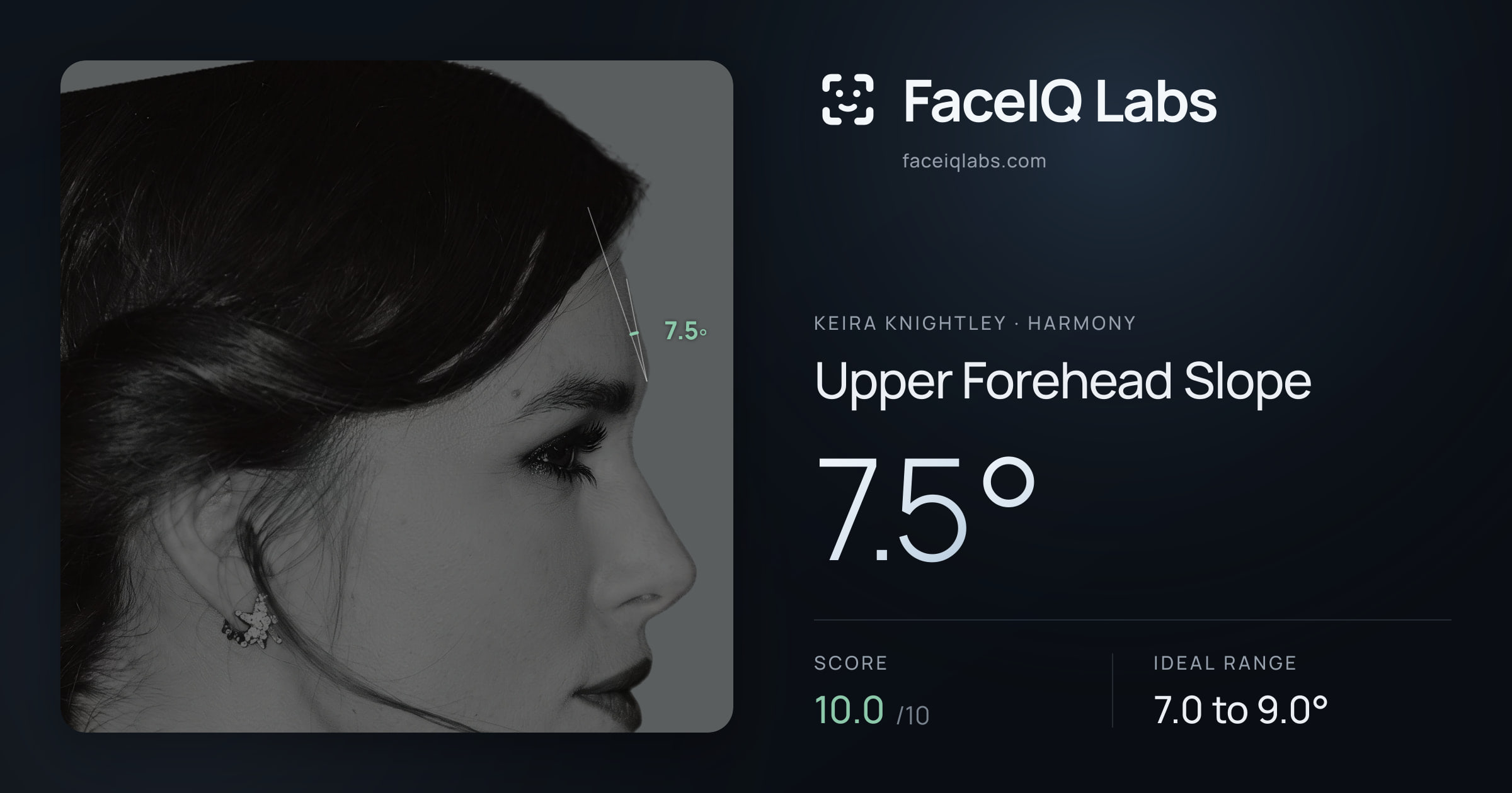 Keira Knightley Upper Forehead Slope: 7.5°, drawn on the photo