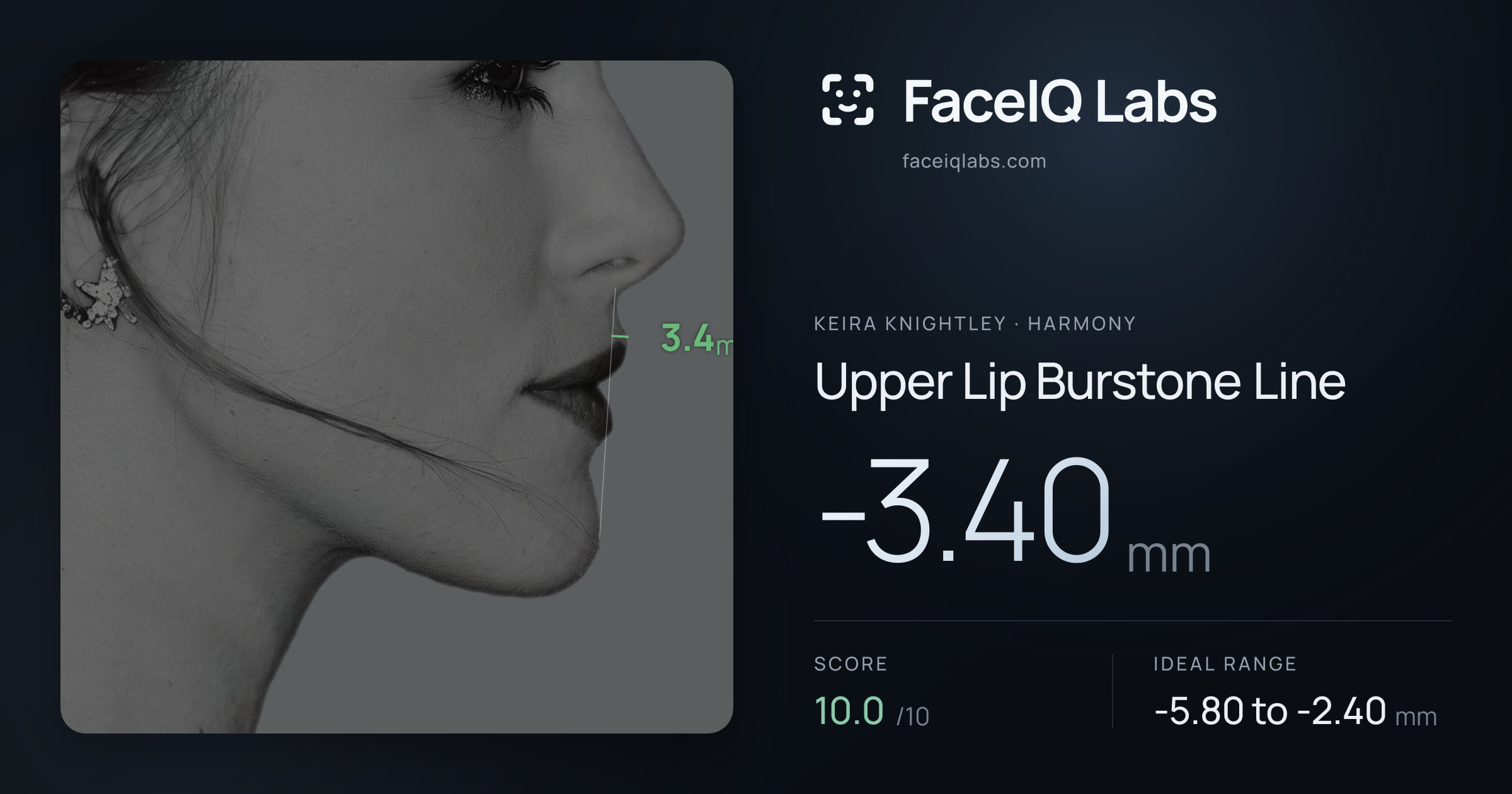 Keira Knightley Upper Lip Burstone Line: -3.40mm, drawn on the photo