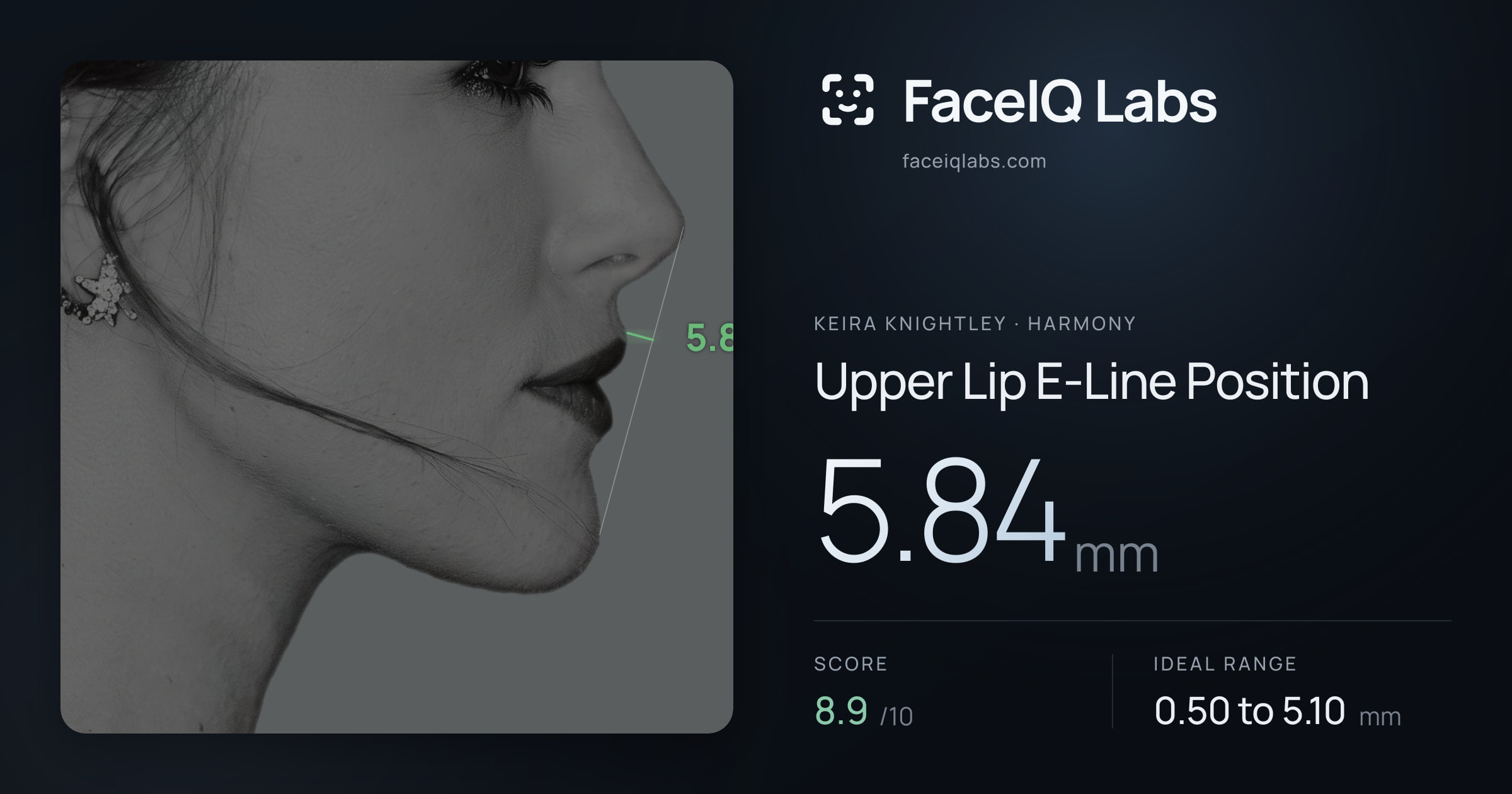 Keira Knightley Upper Lip E-Line Position: 5.84mm, drawn on the photo