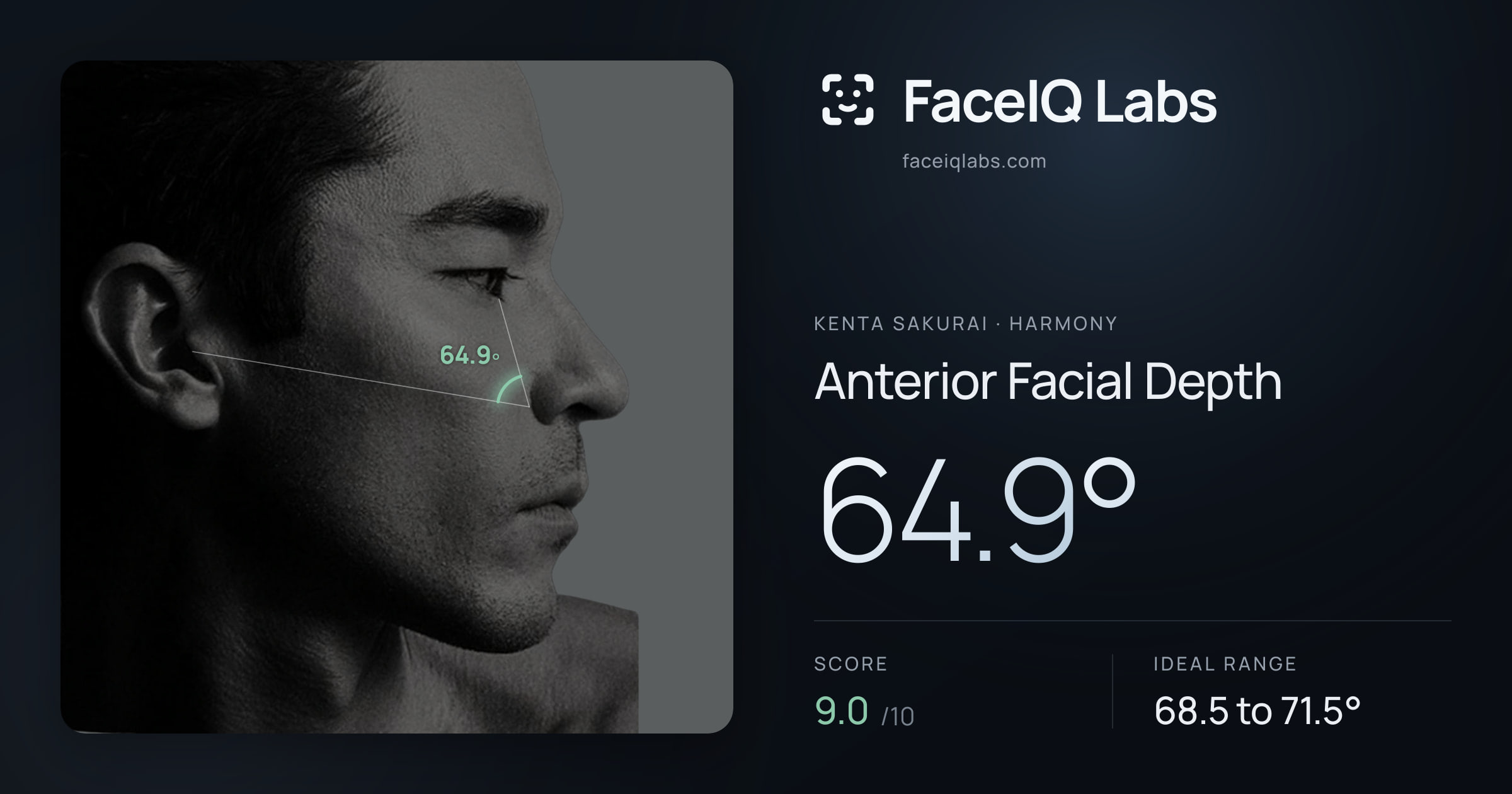 Kenta Sakurai Anterior Facial Depth: 64.9°, drawn on the photo