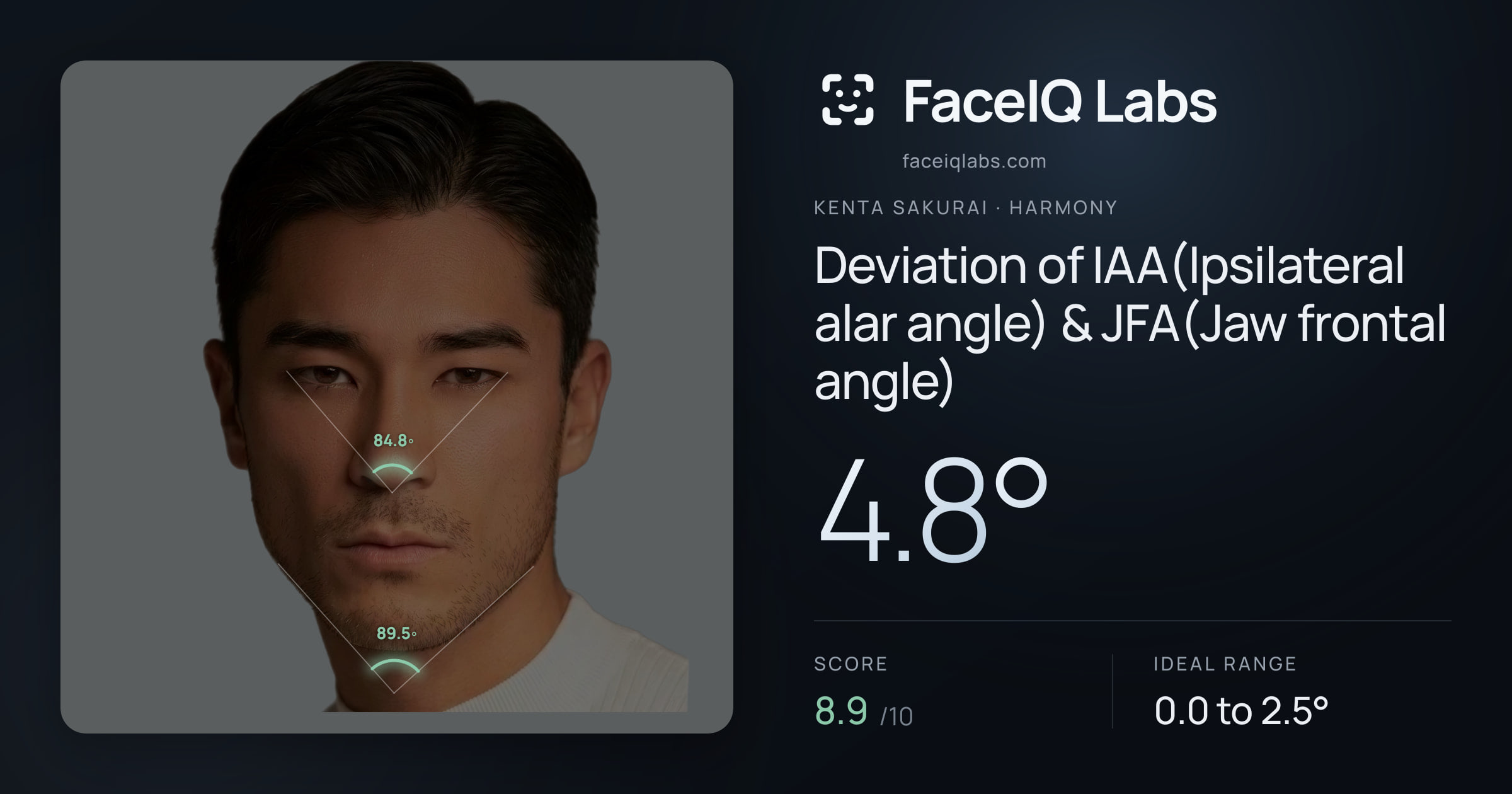 Kenta Sakurai Deviation of IAA(Ipsilateral alar angle) & JFA(Jaw frontal angle): 4.8°, drawn on the photo