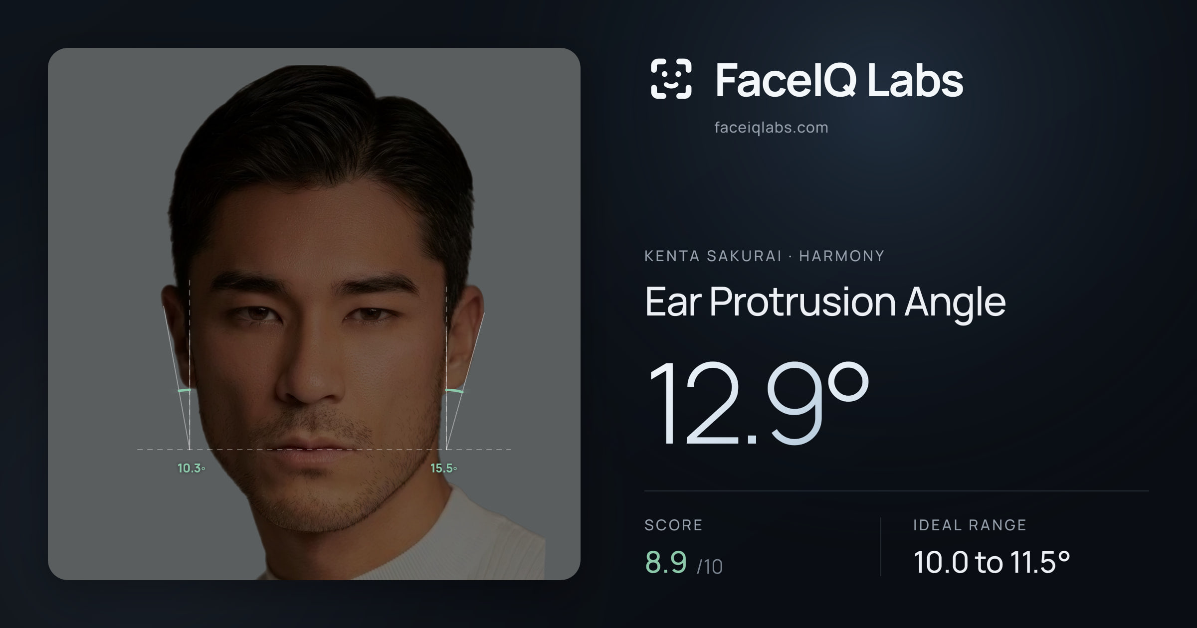 Kenta Sakurai Ear Protrusion Angle: 12.9°, drawn on the photo
