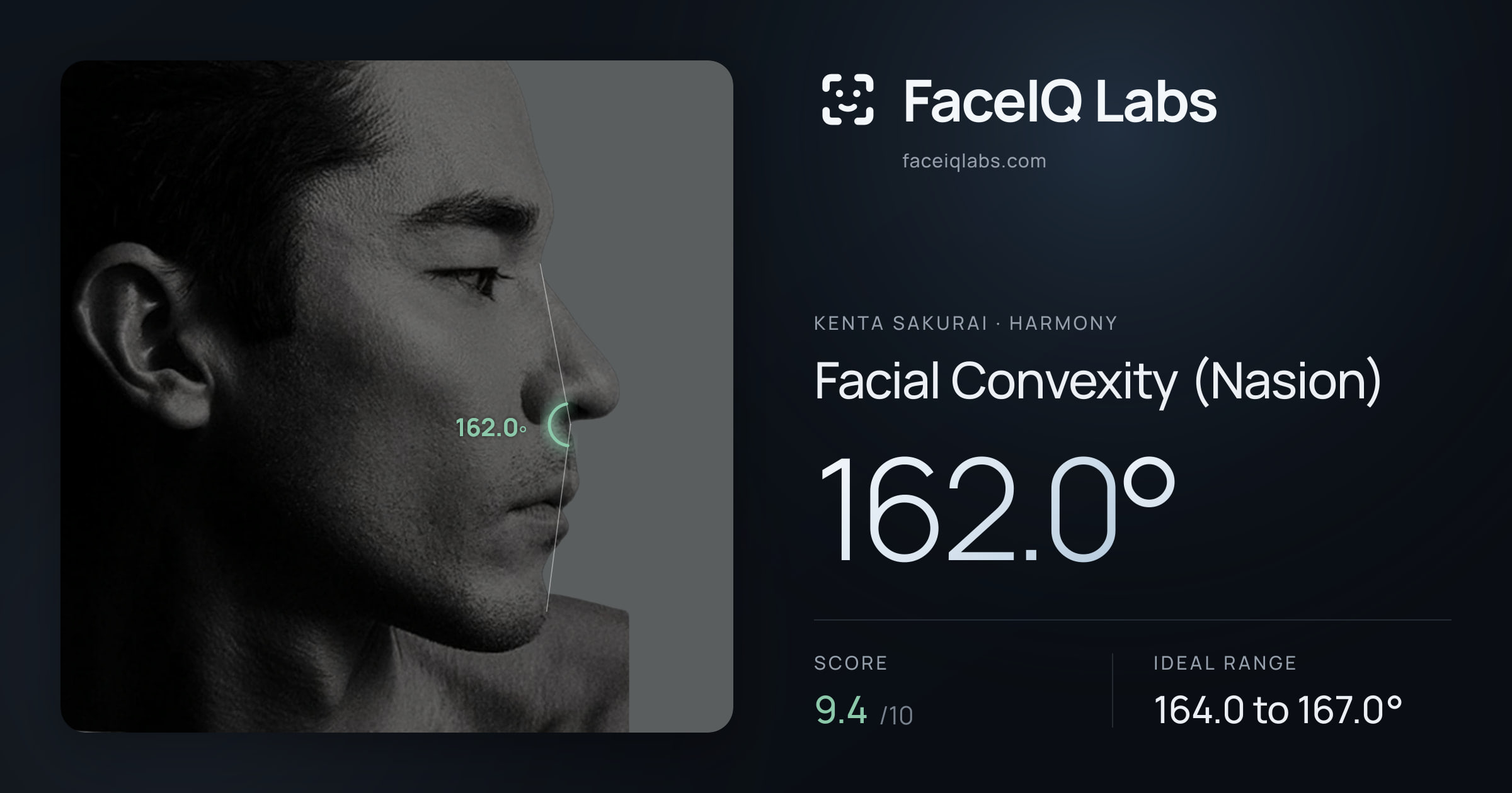 Kenta Sakurai Facial Convexity (Nasion): 162.0°, drawn on the photo