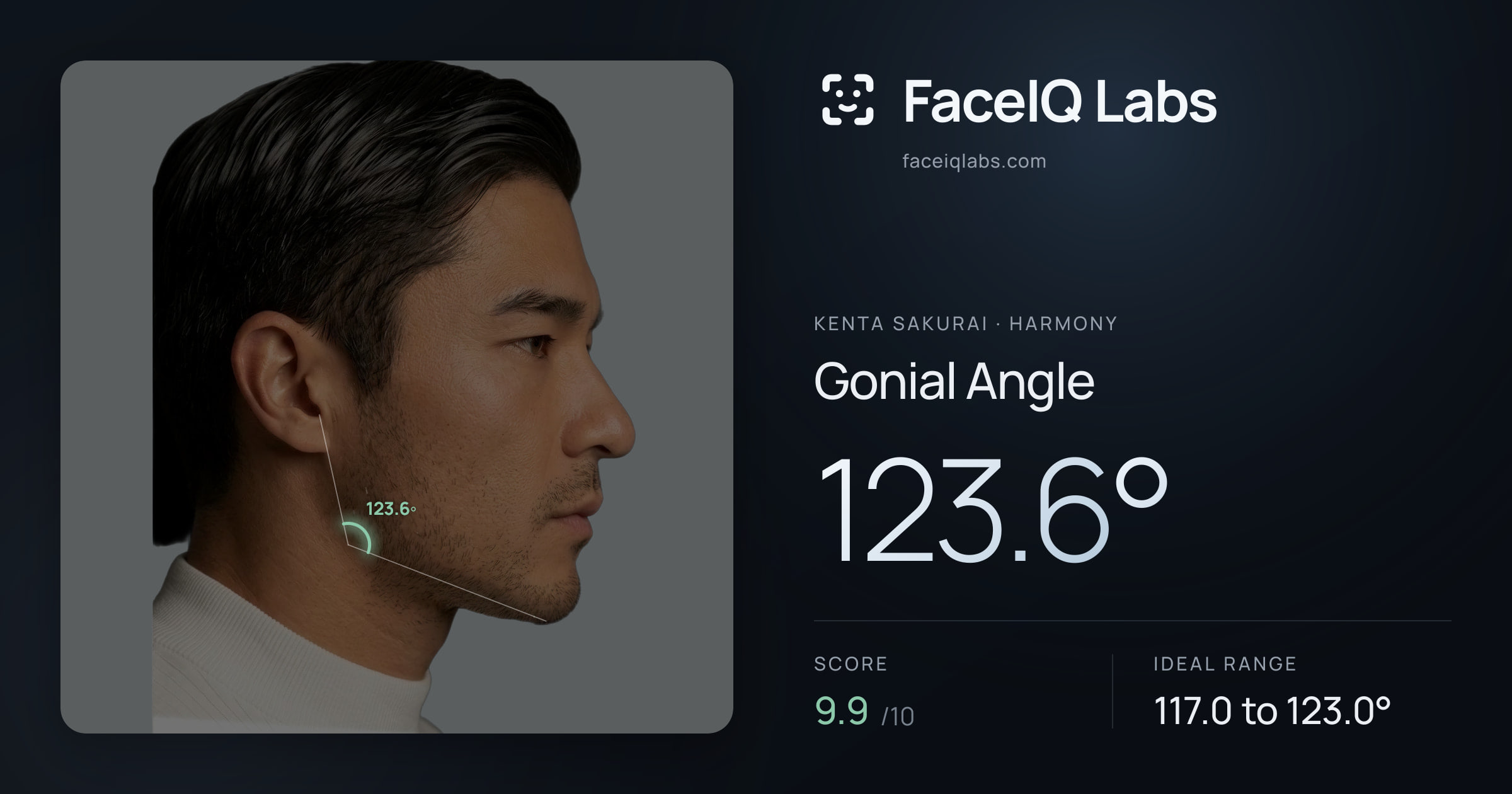 Kenta Sakurai Gonial Angle: 134.8°, drawn on the photo
