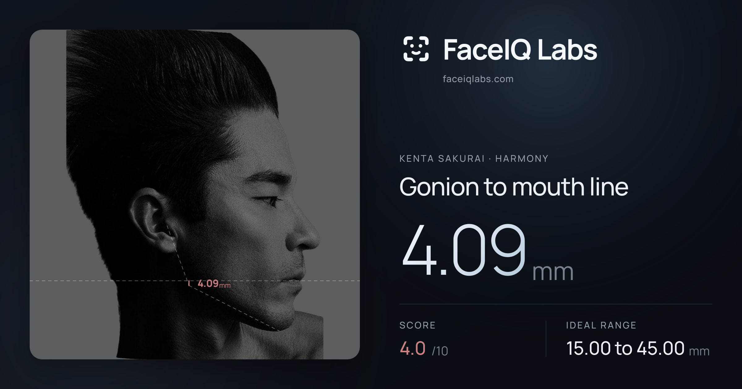 Kenta Sakurai Gonion to mouth line: 4.09mm, drawn on the photo