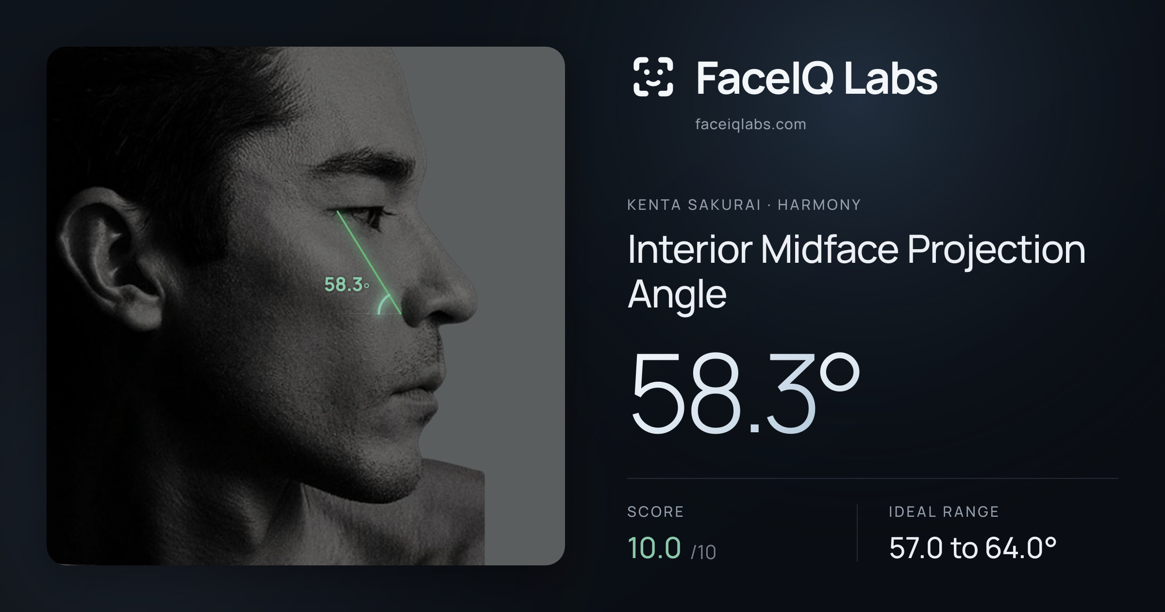 Kenta Sakurai Interior Midface Projection Angle: 58.3°, drawn on the photo