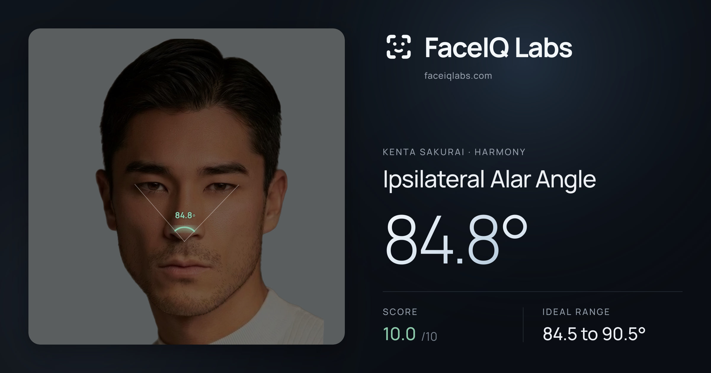 Kenta Sakurai Ipsilateral Alar Angle: 84.8°, drawn on the photo