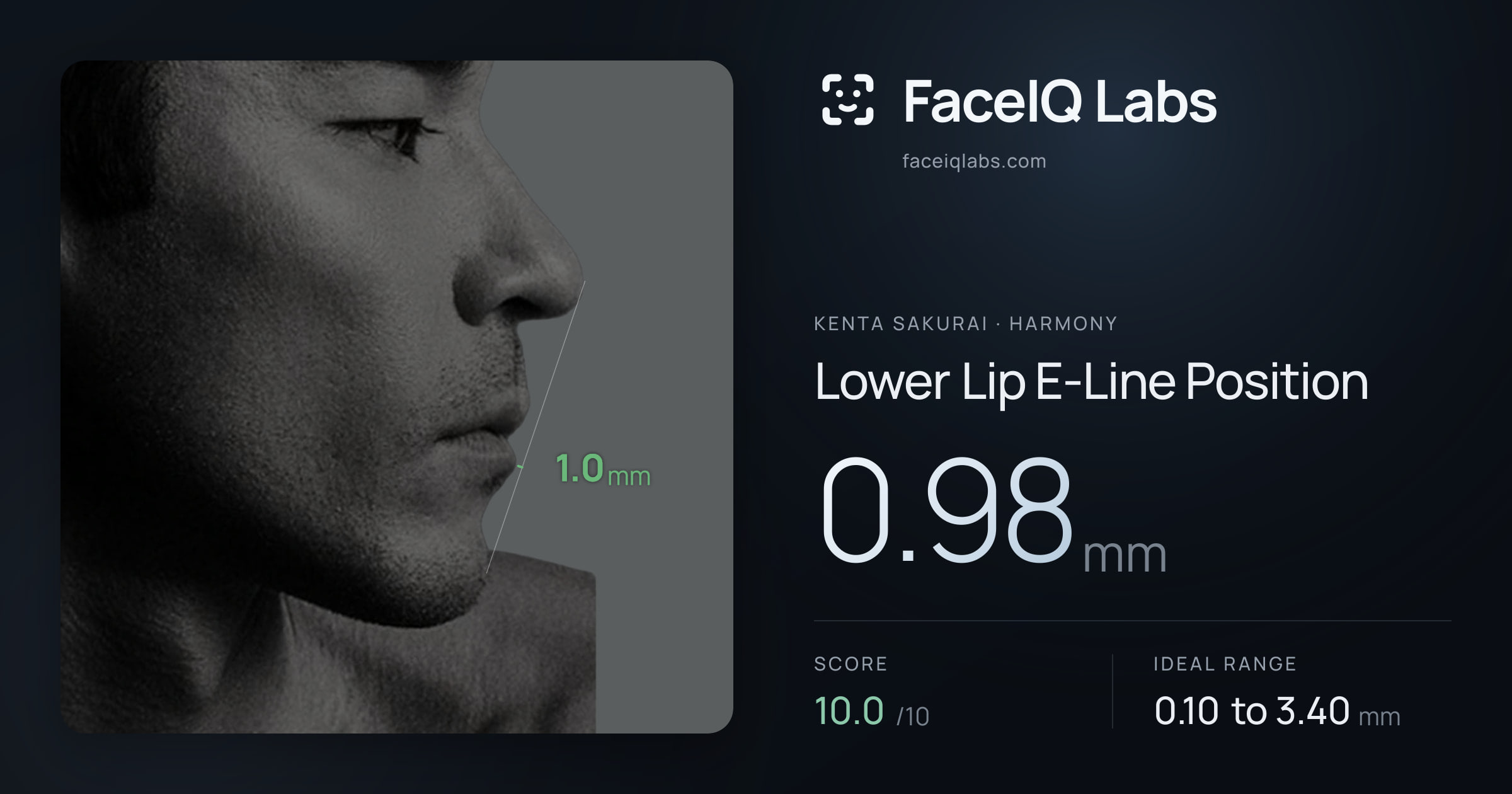 Kenta Sakurai Lower Lip E-Line Position: 0.98mm, drawn on the photo