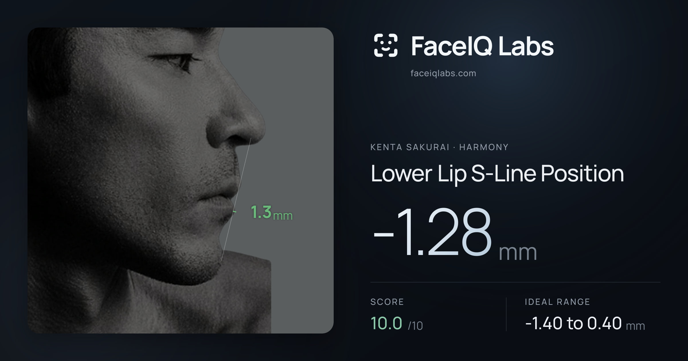 Kenta Sakurai Lower Lip S-Line Position: -1.28mm, drawn on the photo