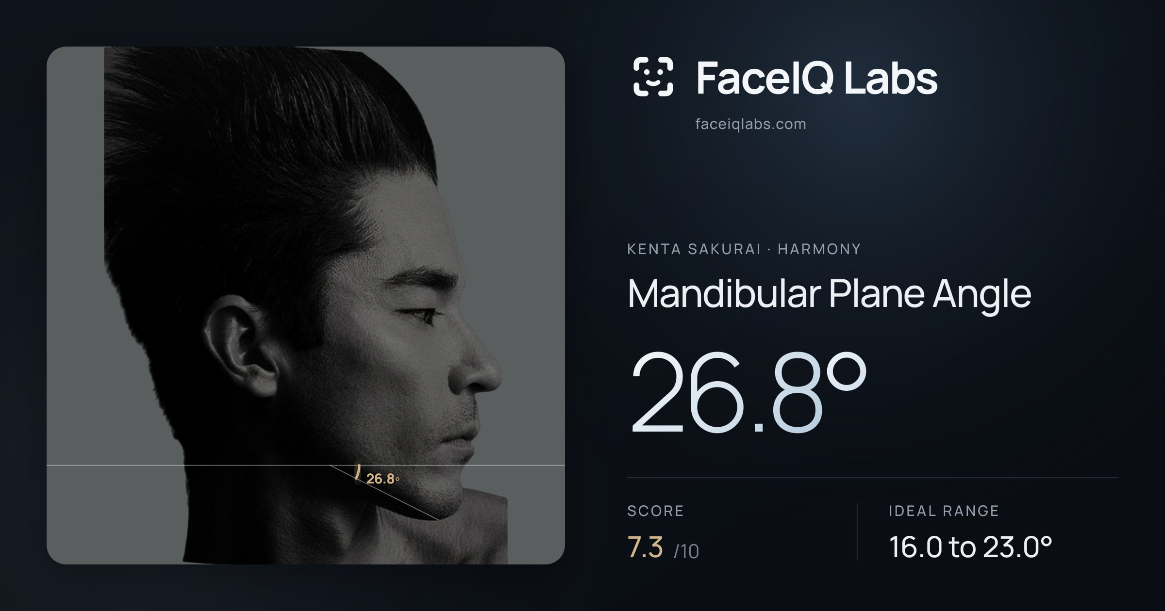 Kenta Sakurai Mandibular Plane Angle: 26.8°, drawn on the photo