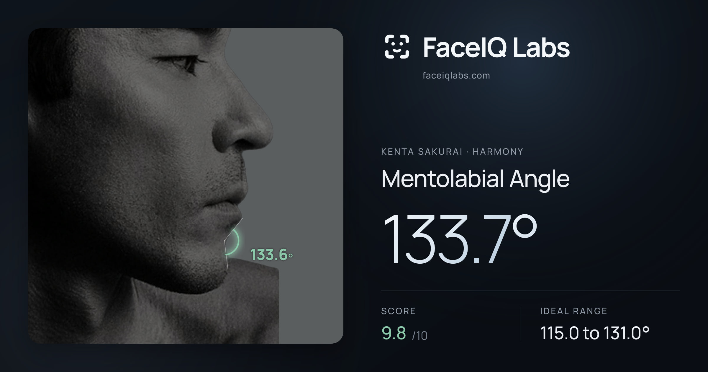 Kenta Sakurai Mentolabial Angle: 133.7°, drawn on the photo