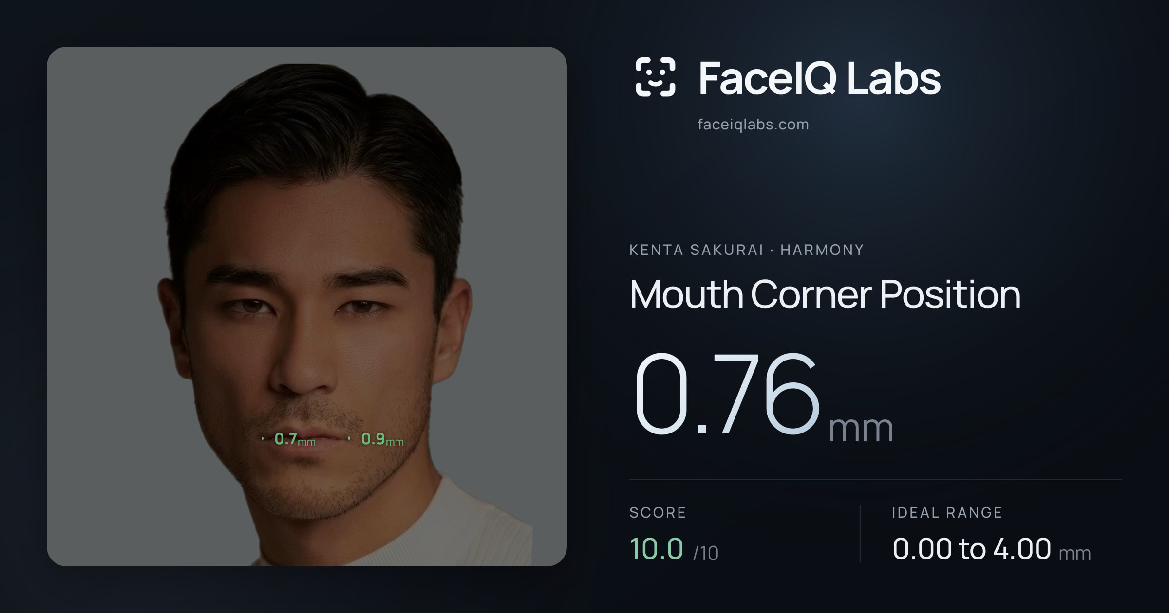 Kenta Sakurai Mouth Corner Position: 0.76mm, drawn on the photo