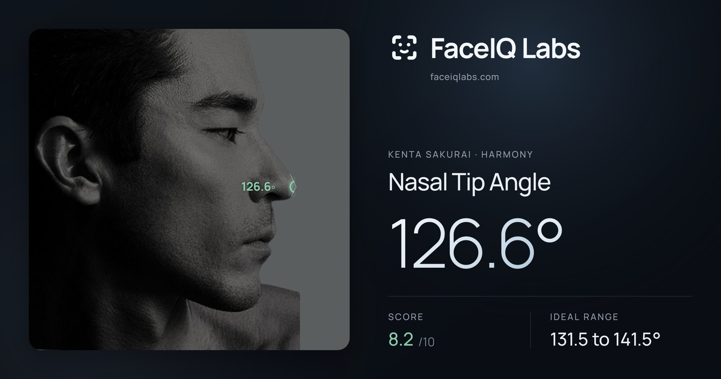 Kenta Sakurai Nasal Tip Angle: 126.6°, drawn on the photo