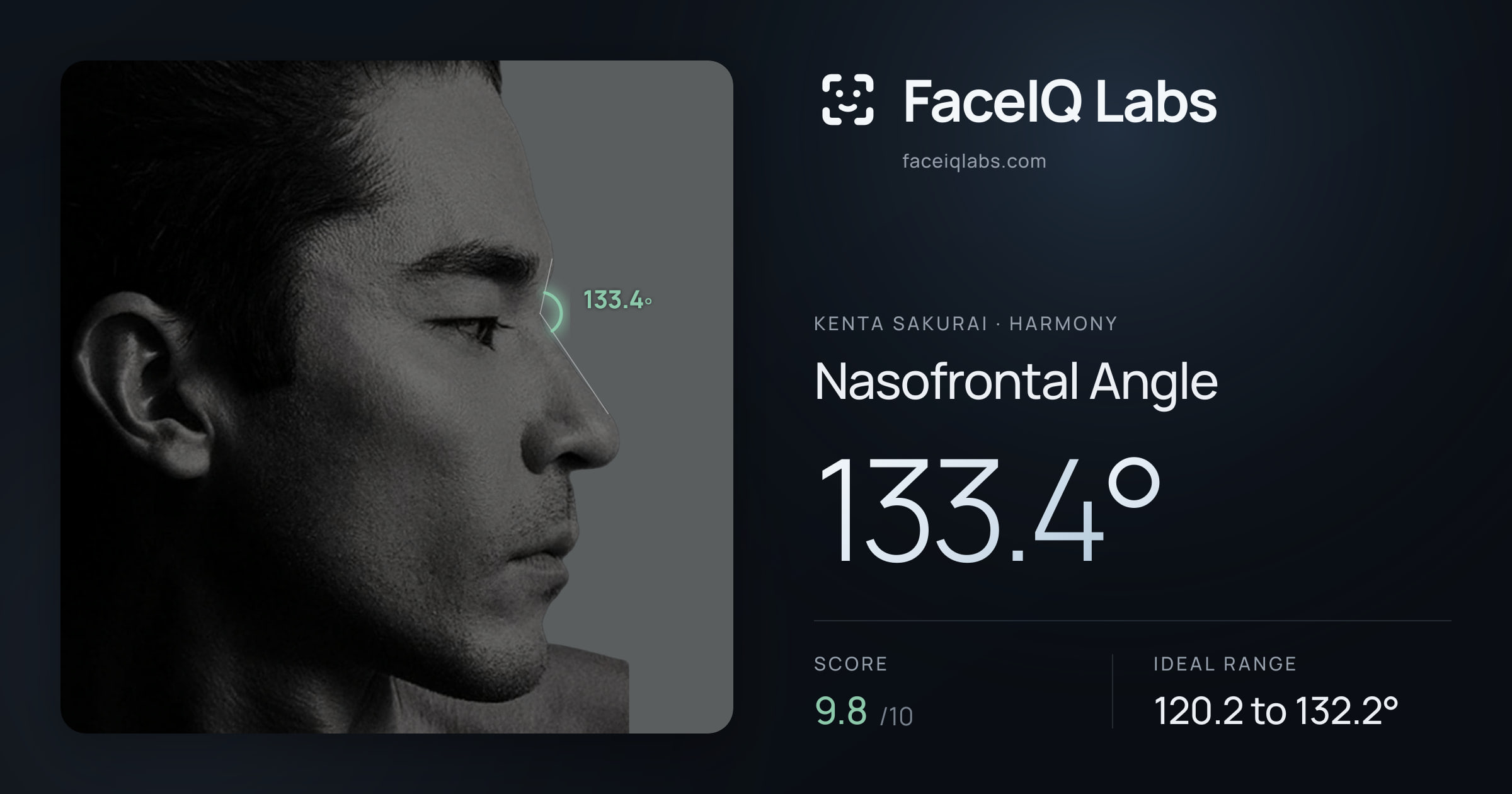 Kenta Sakurai Nasofrontal Angle: 133.4°, drawn on the photo