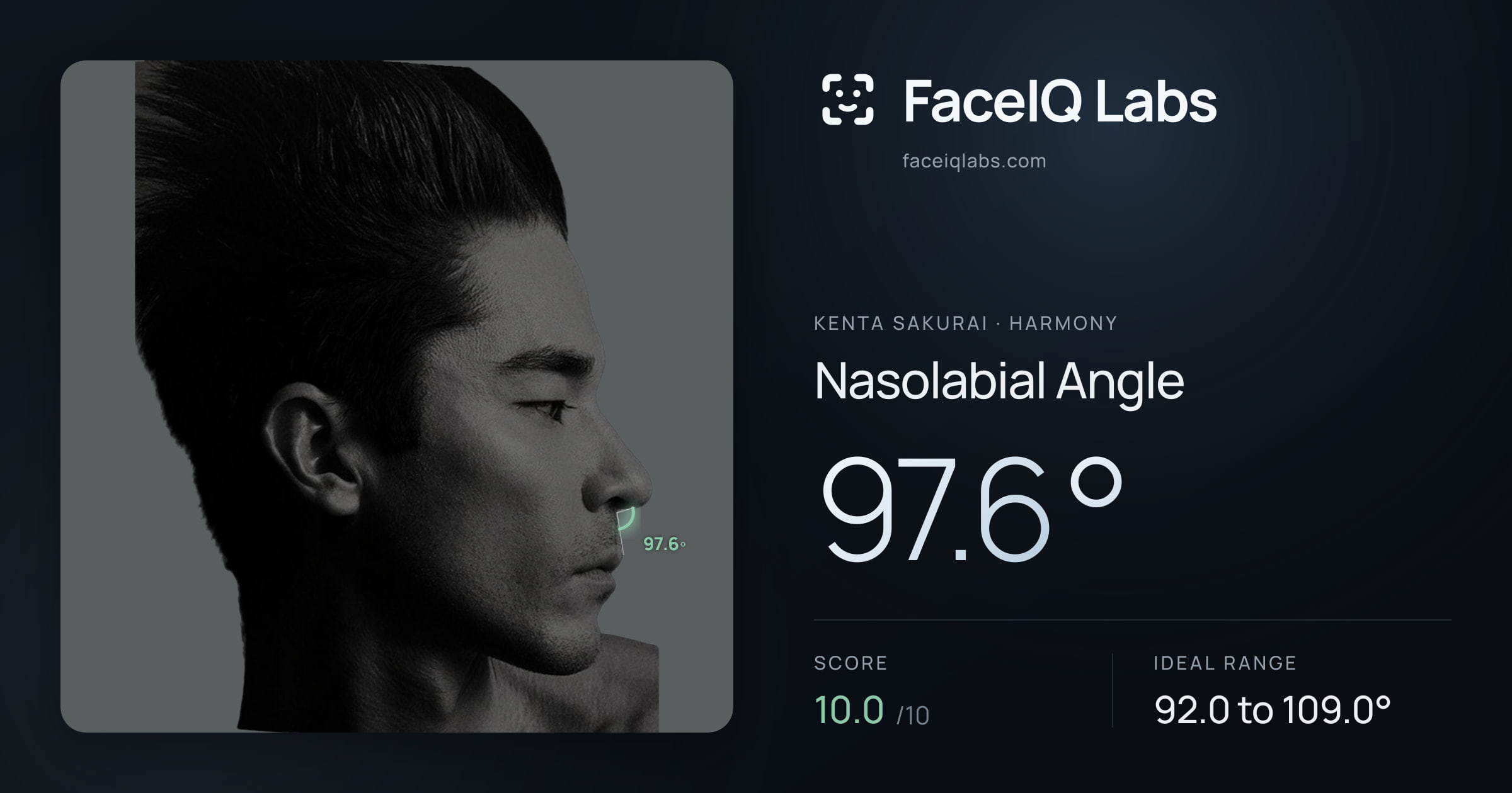 Kenta Sakurai Nasolabial Angle: 97.6°, drawn on the photo