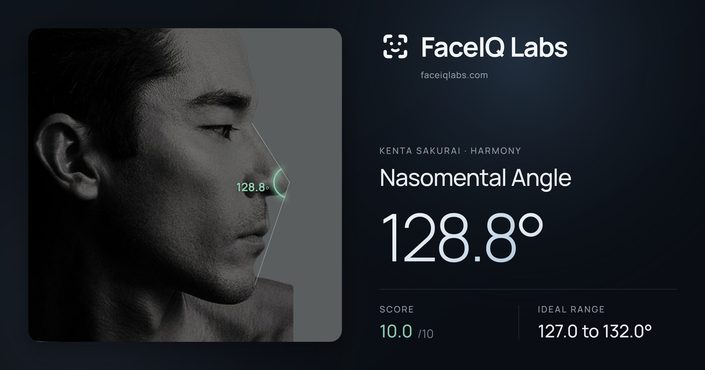 Kenta Sakurai Nasomental Angle: 128.8°, drawn on the photo