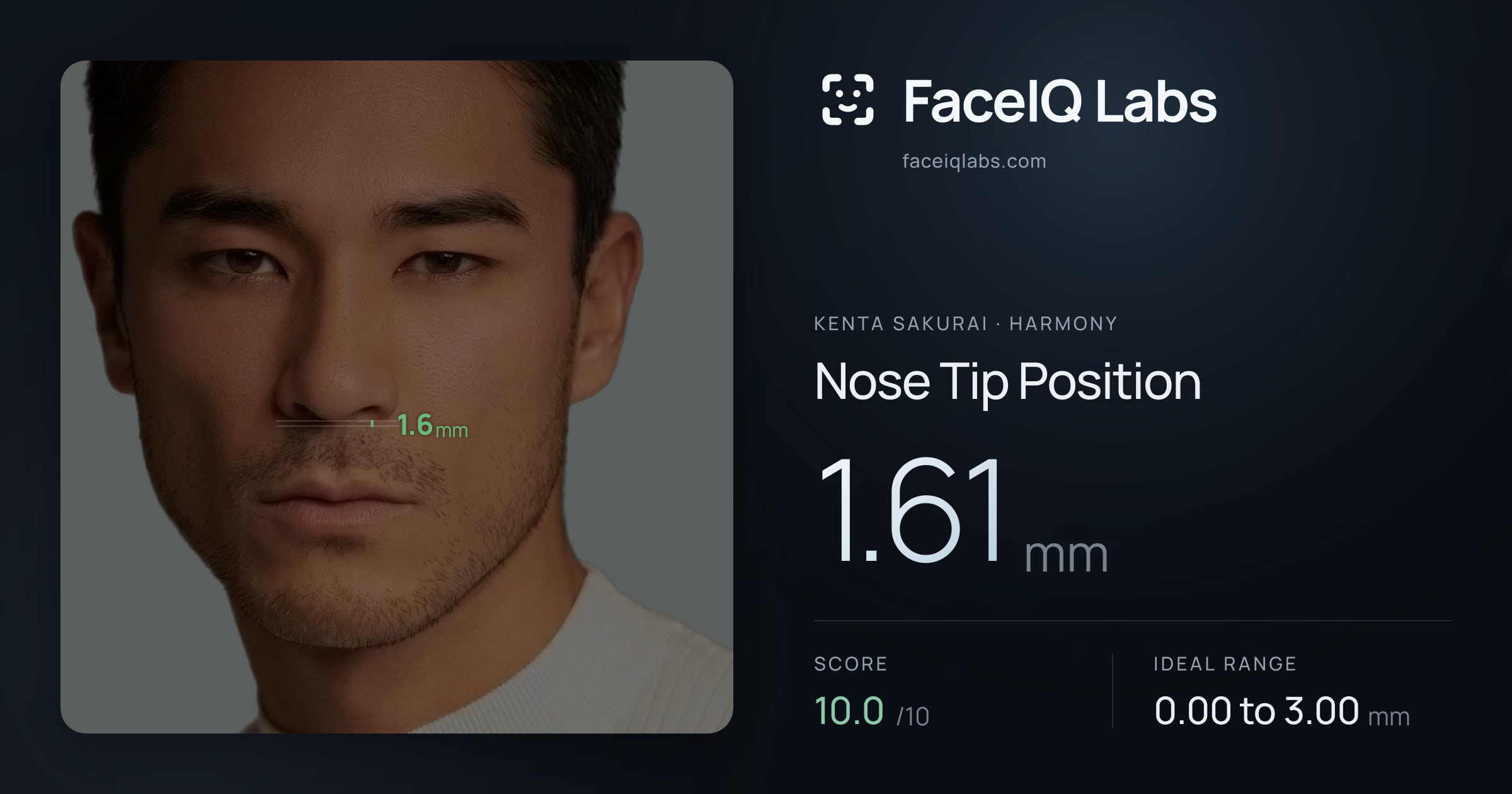 Kenta Sakurai Nose Tip Position: 1.61mm, drawn on the photo