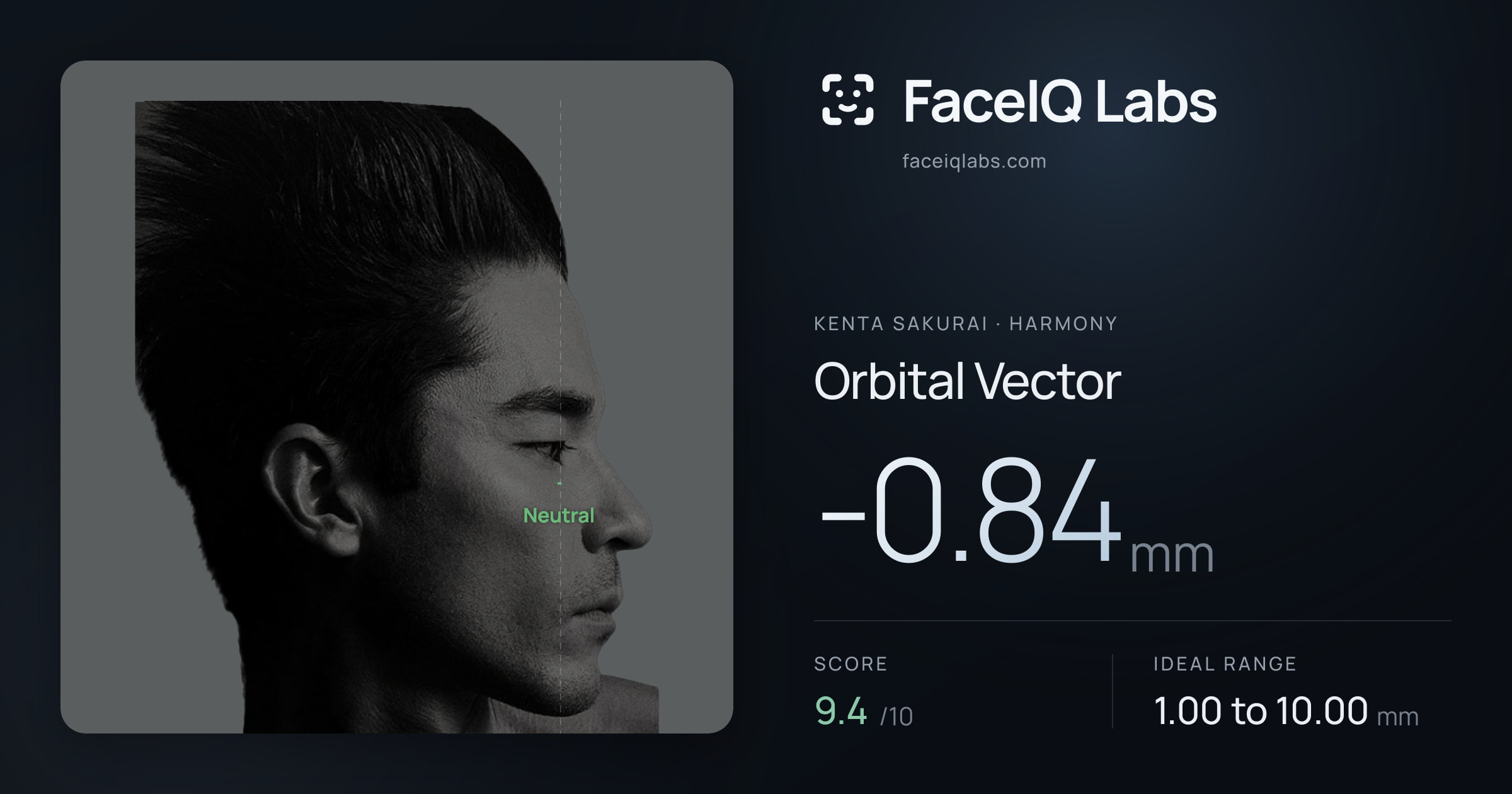 Kenta Sakurai Orbital Vector: -0.84mm, drawn on the photo