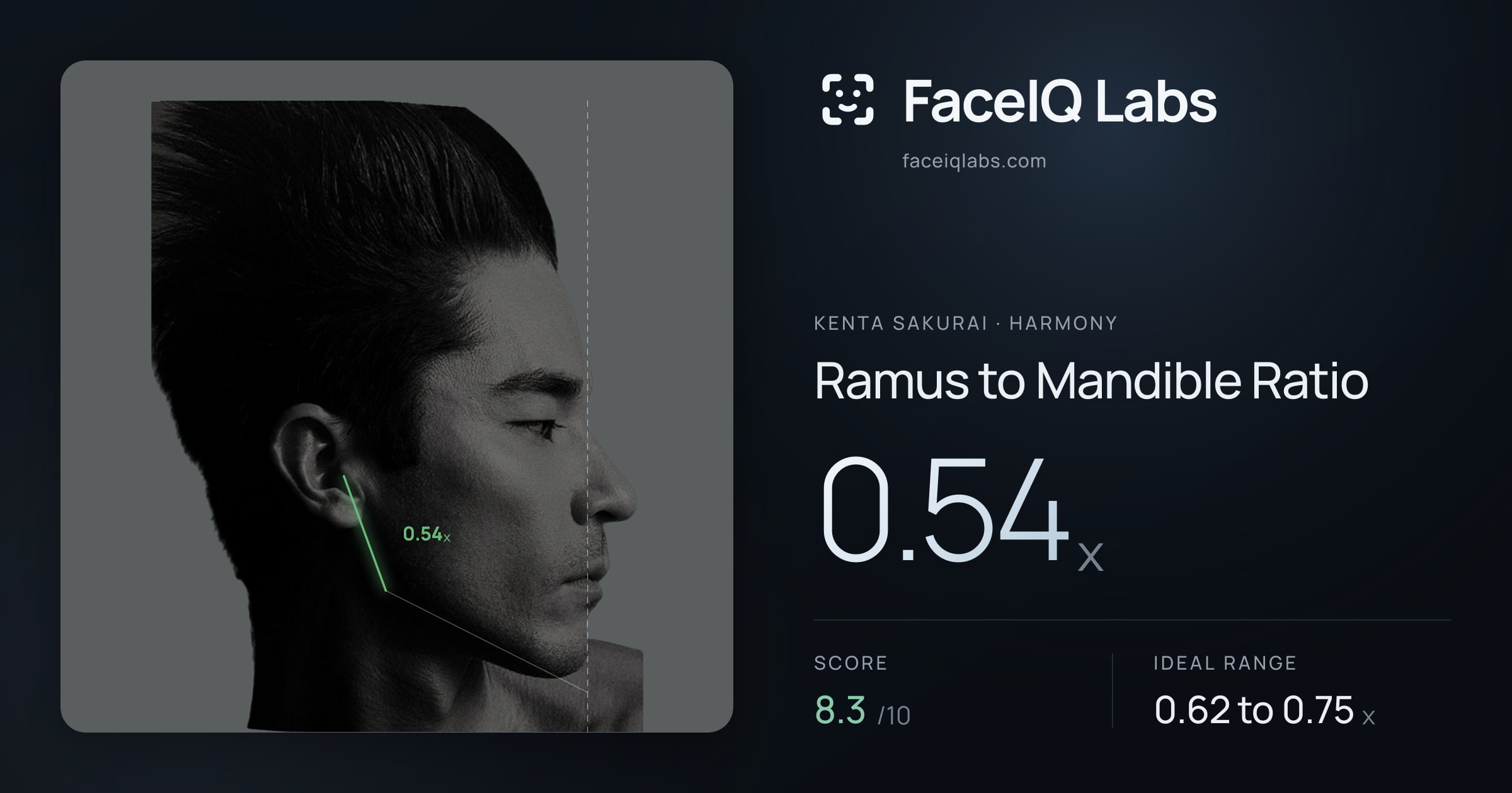 Kenta Sakurai Ramus to Mandible Ratio: 0.54x, drawn on the photo