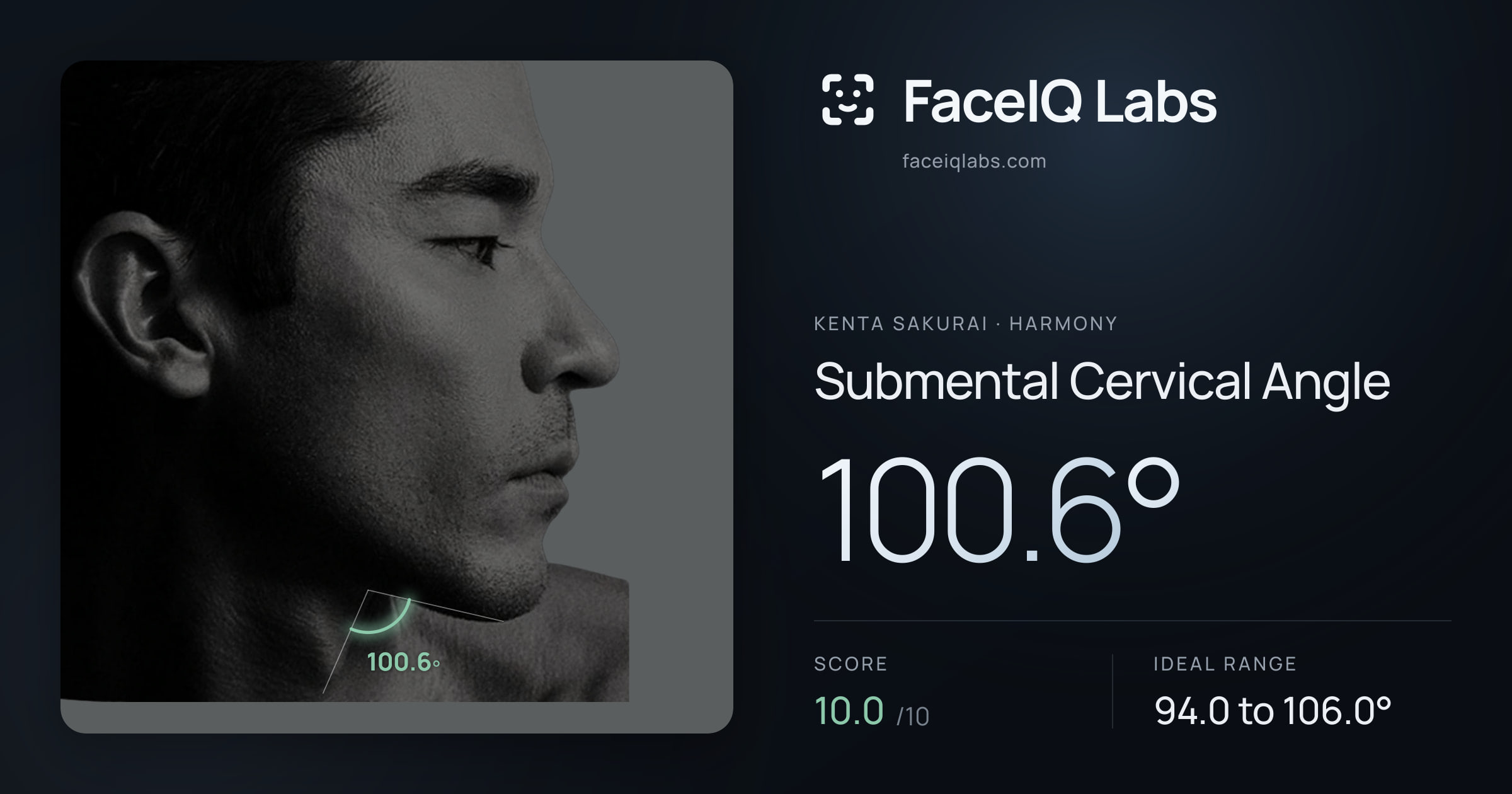 Kenta Sakurai Submental Cervical Angle: 100.6°, drawn on the photo