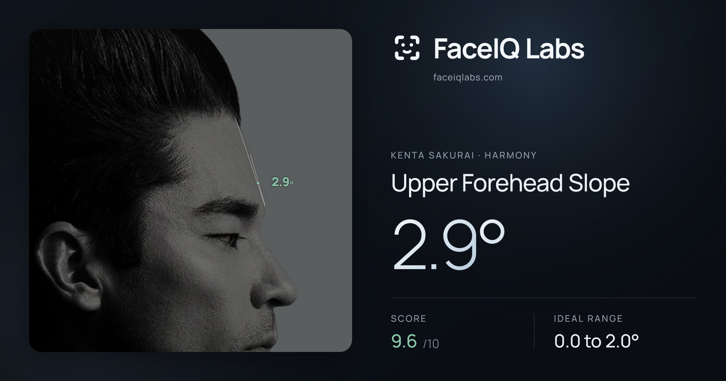 Kenta Sakurai Upper Forehead Slope: 2.9°, drawn on the photo